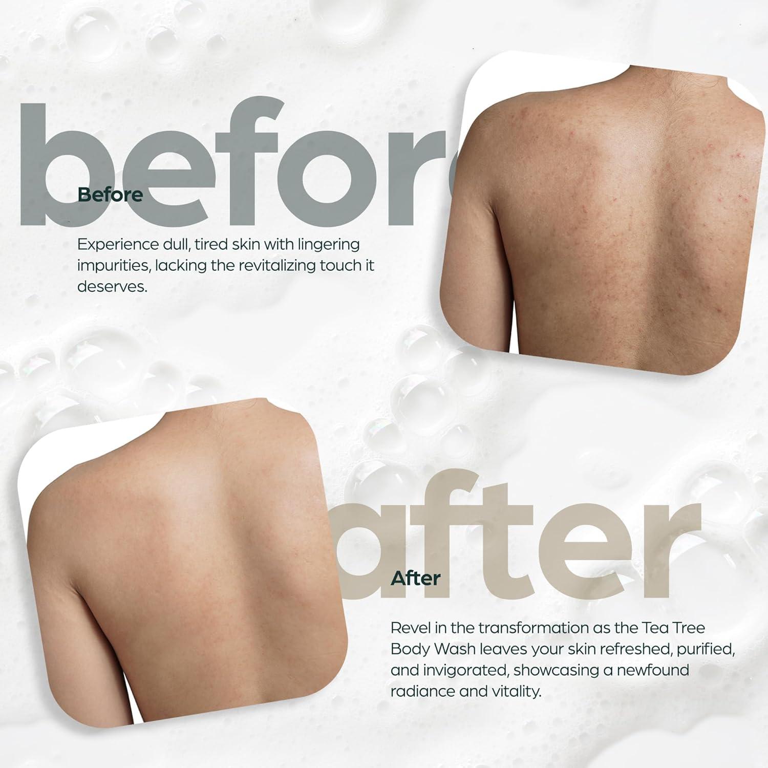 Jabón Corporal Antibacteriano Artnaturals 2x473ml Aceite de Árbol de Té