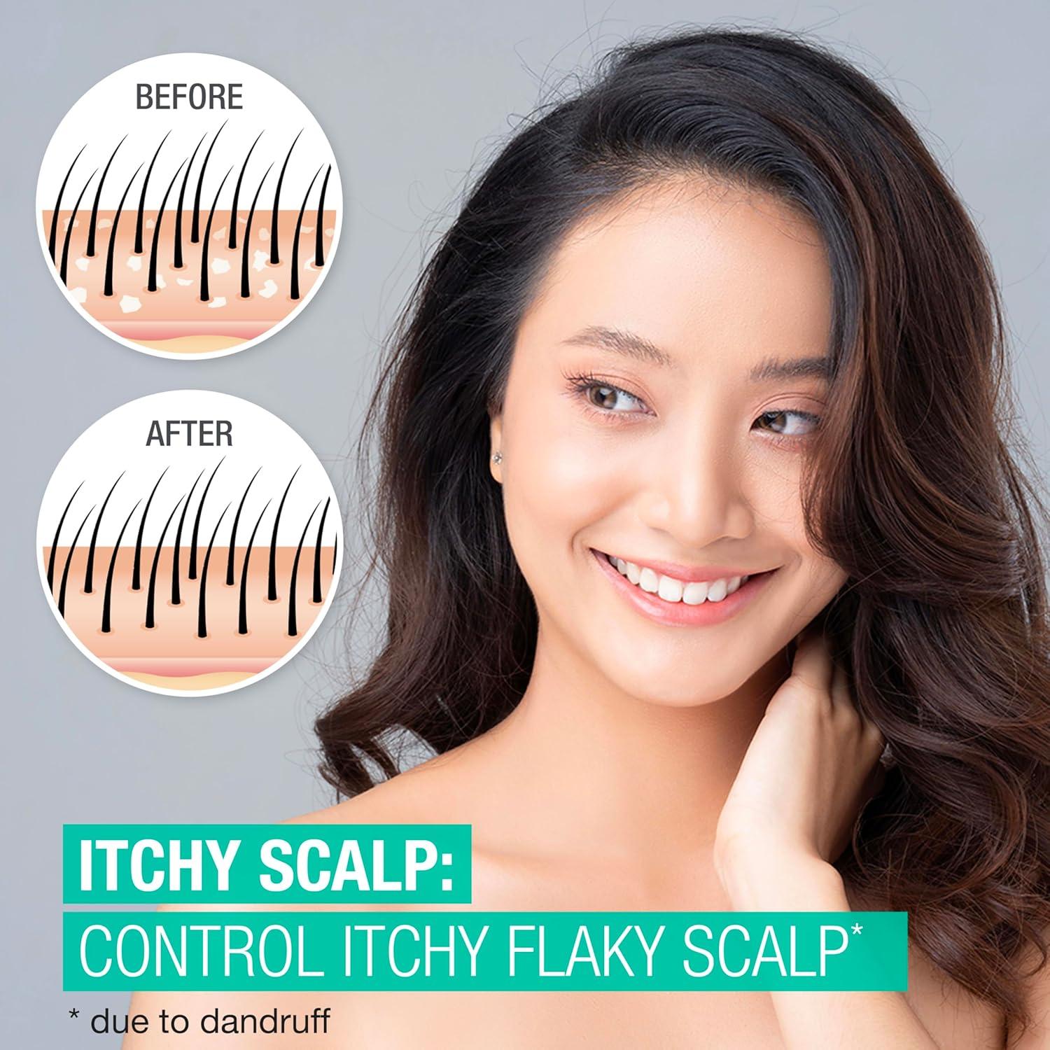 Champú Anticaspa Neutrogena 2.5% Ácido Salicílico 355ml