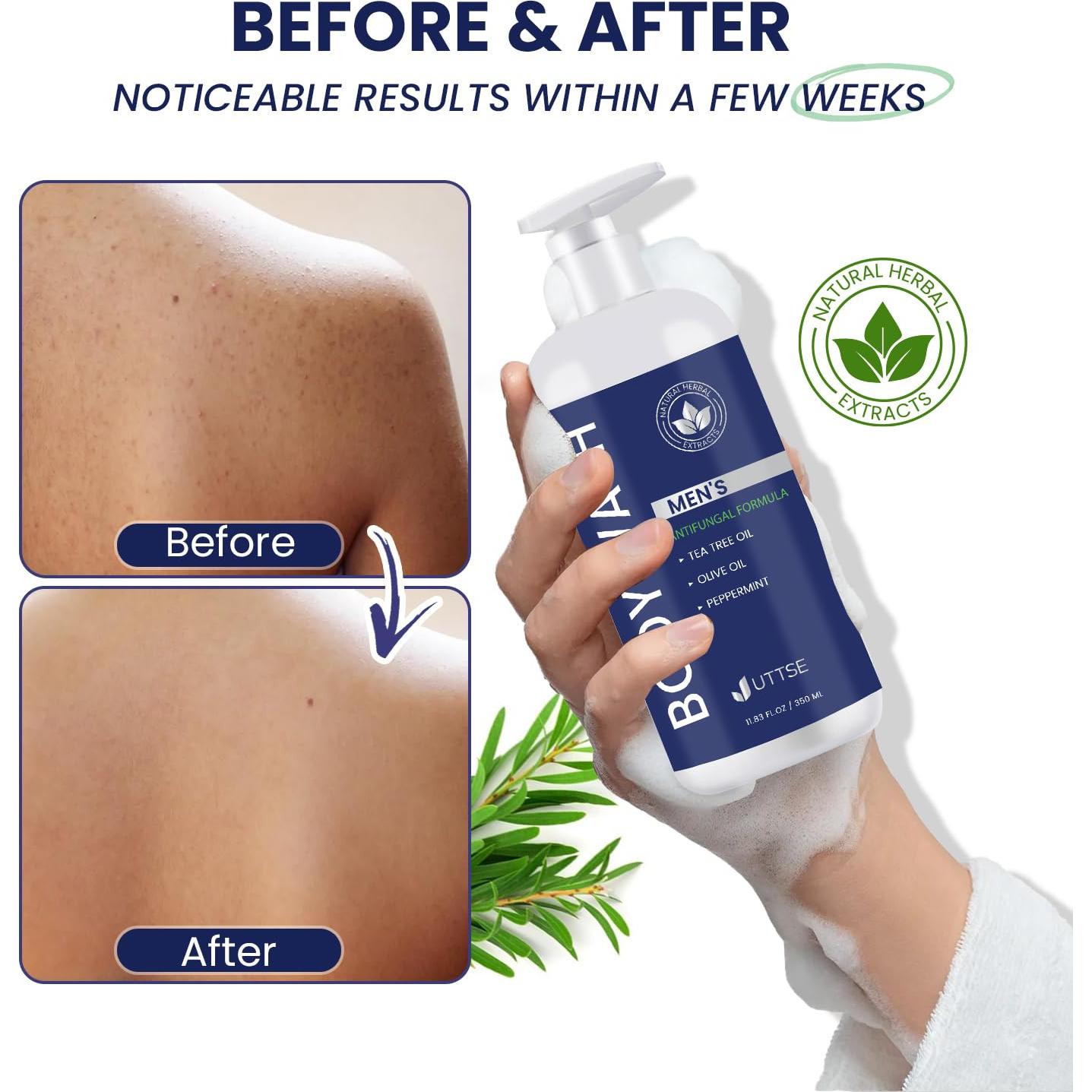 Jabón Corporal Antifúngico Uttse 350 mL - Árbol de Té