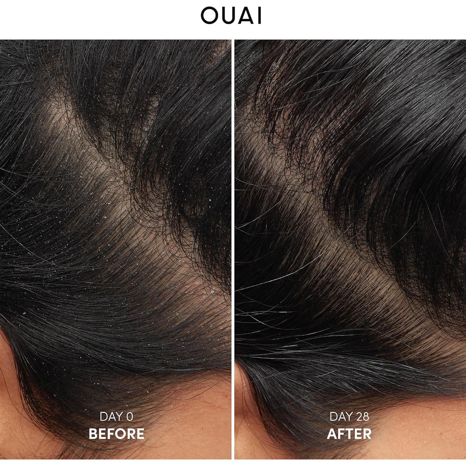 Champú Anticaspa OUAI 300 ml - Suave con Ácido Salicílico