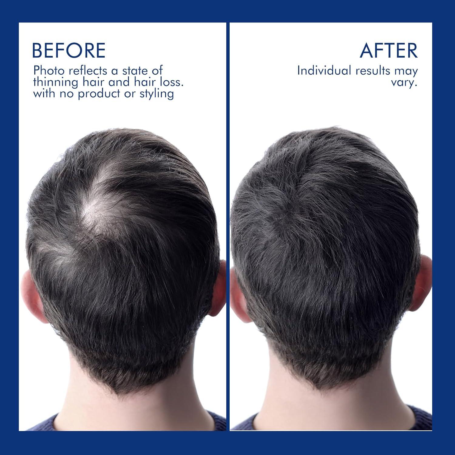 Champú Engrosante Ceson&Cesun 300 ml para Hombres y Mujeres