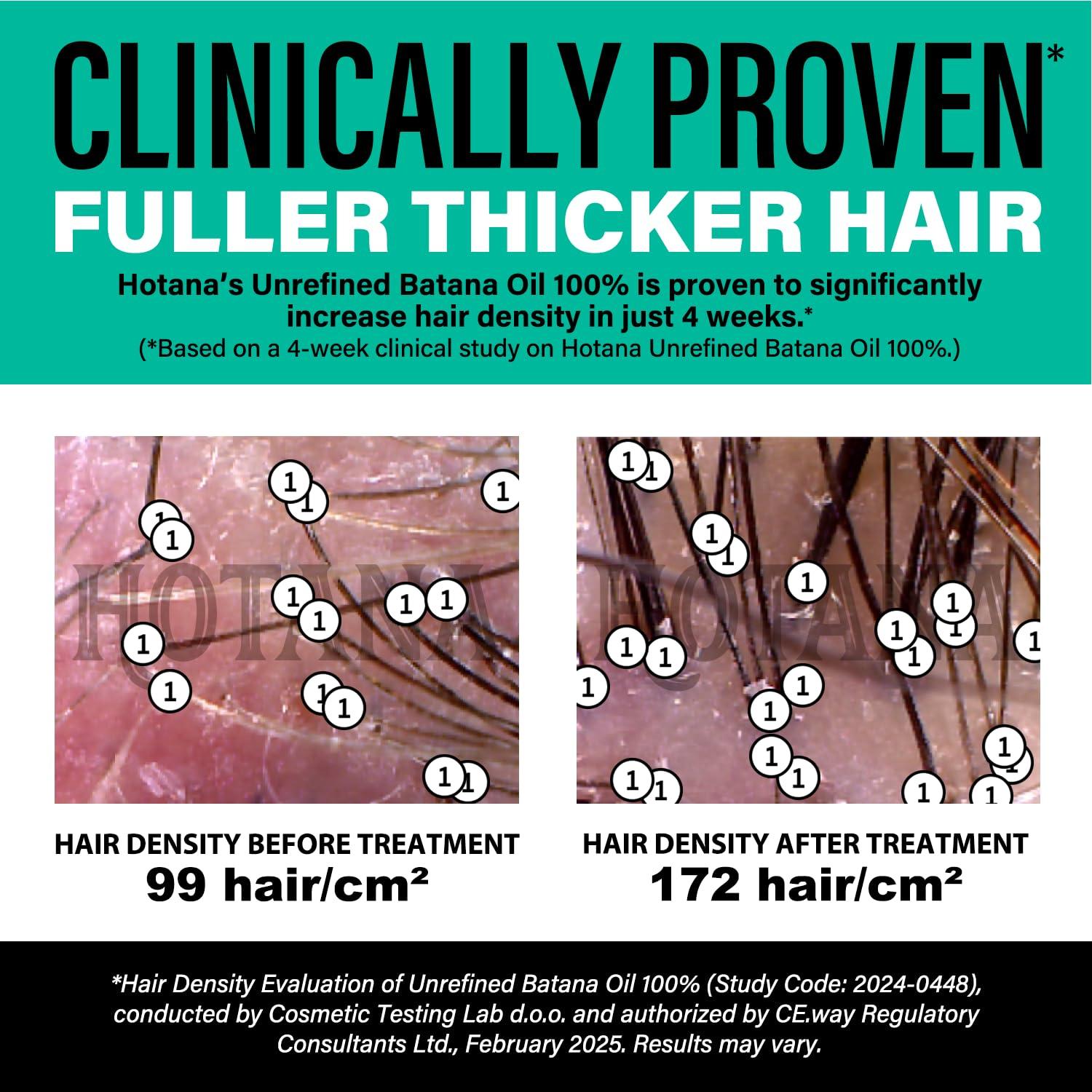 Aceite de Batana Sin Refinar Dr Sebi 113 g - Crecimiento Cabello