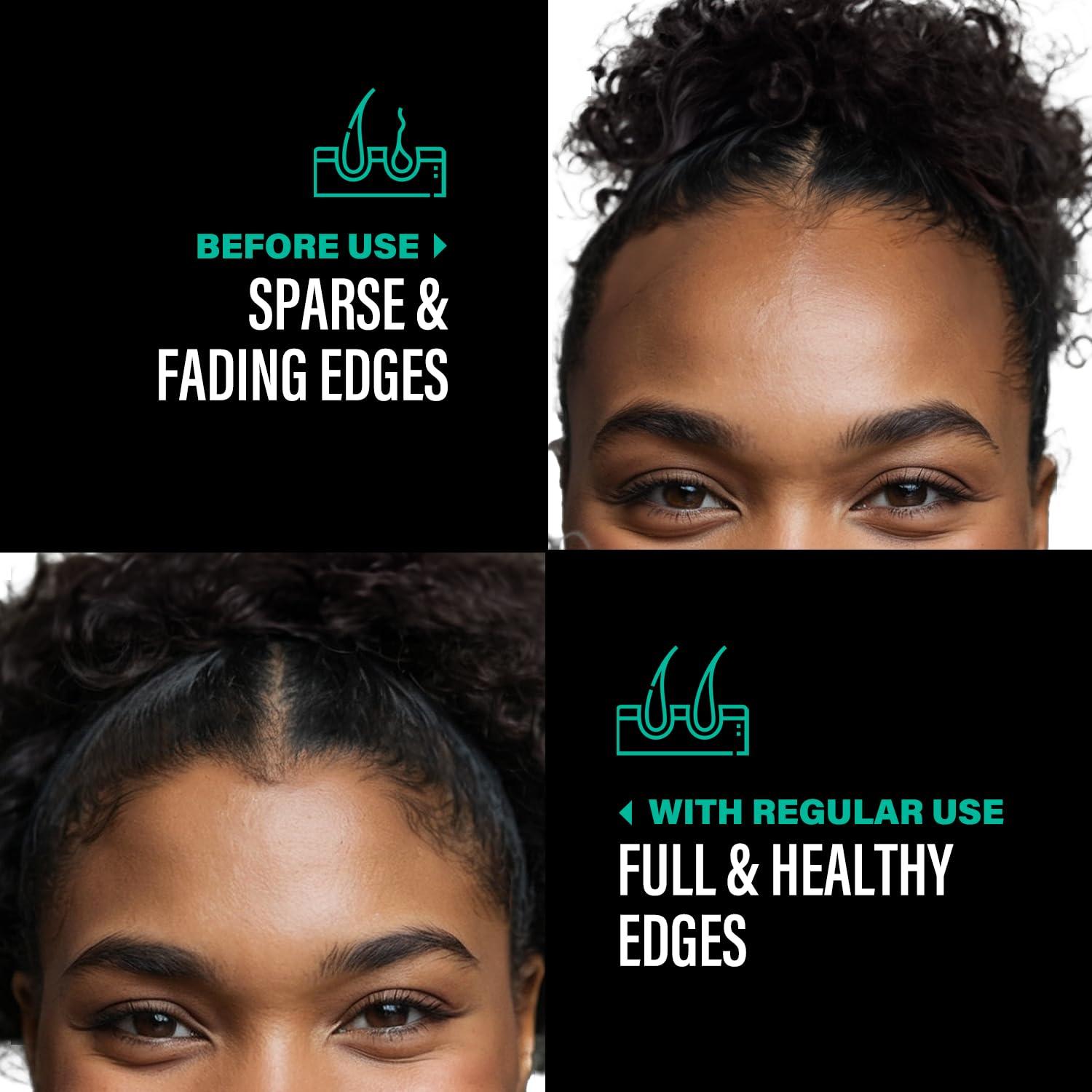 Aceite de Batana Sin Refinar Dr Sebi 113 g - Crecimiento Cabello