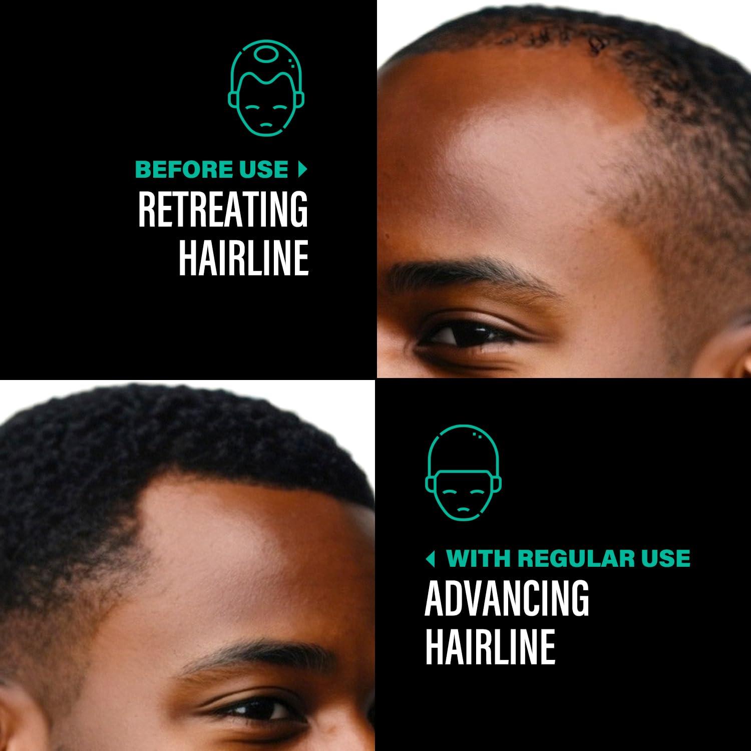 Aceite de Batana Sin Refinar Dr Sebi 113 g - Crecimiento Cabello