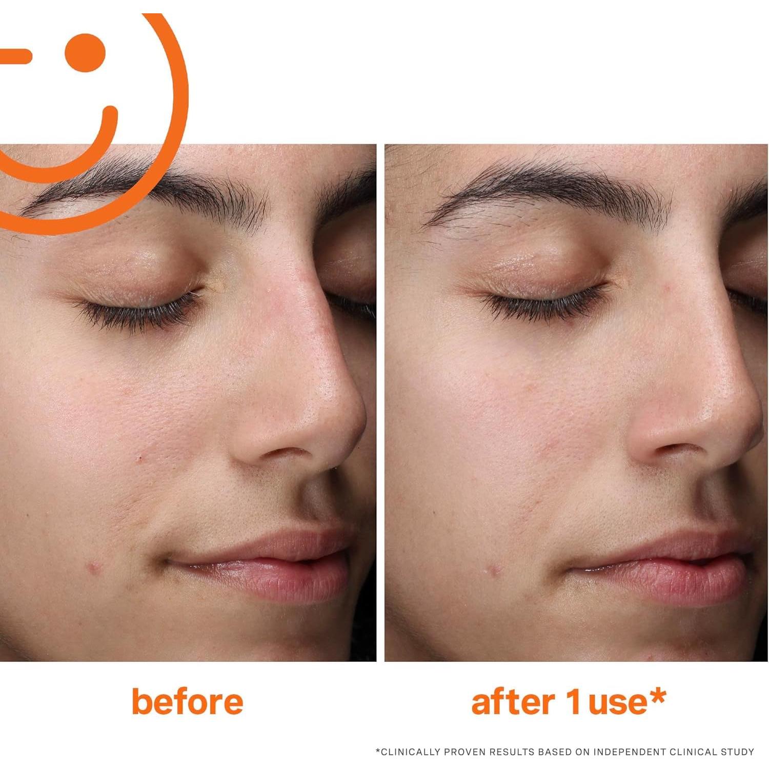 Limpiador Exfoliante Espumoso Diario Kate Somerville 50ml