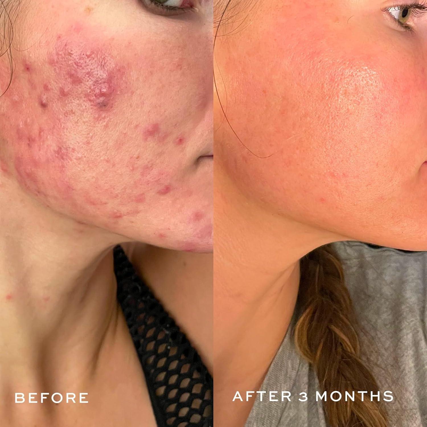 DIME Beauty Crema Limpiadora Espumosa 120ml Piel Grasa