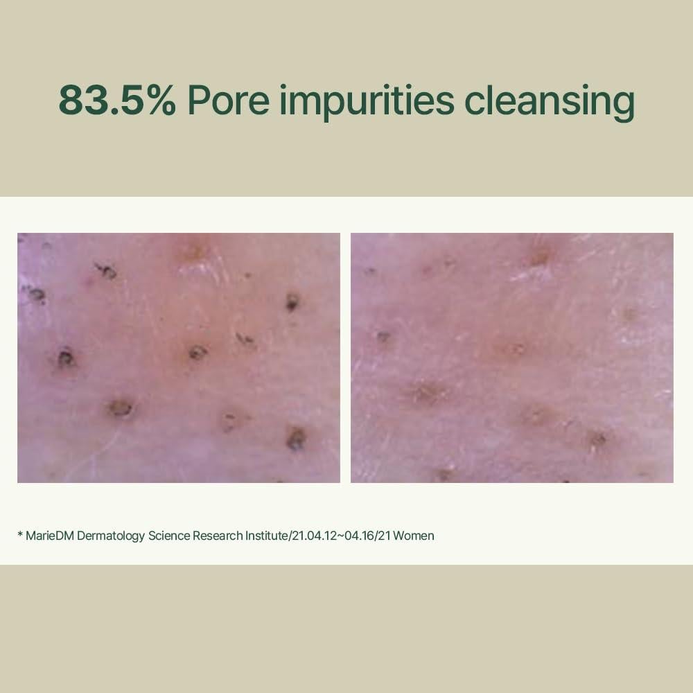 Limpiador Espumoso Calmante Pyunkang Yul 150ml Piel Sensible