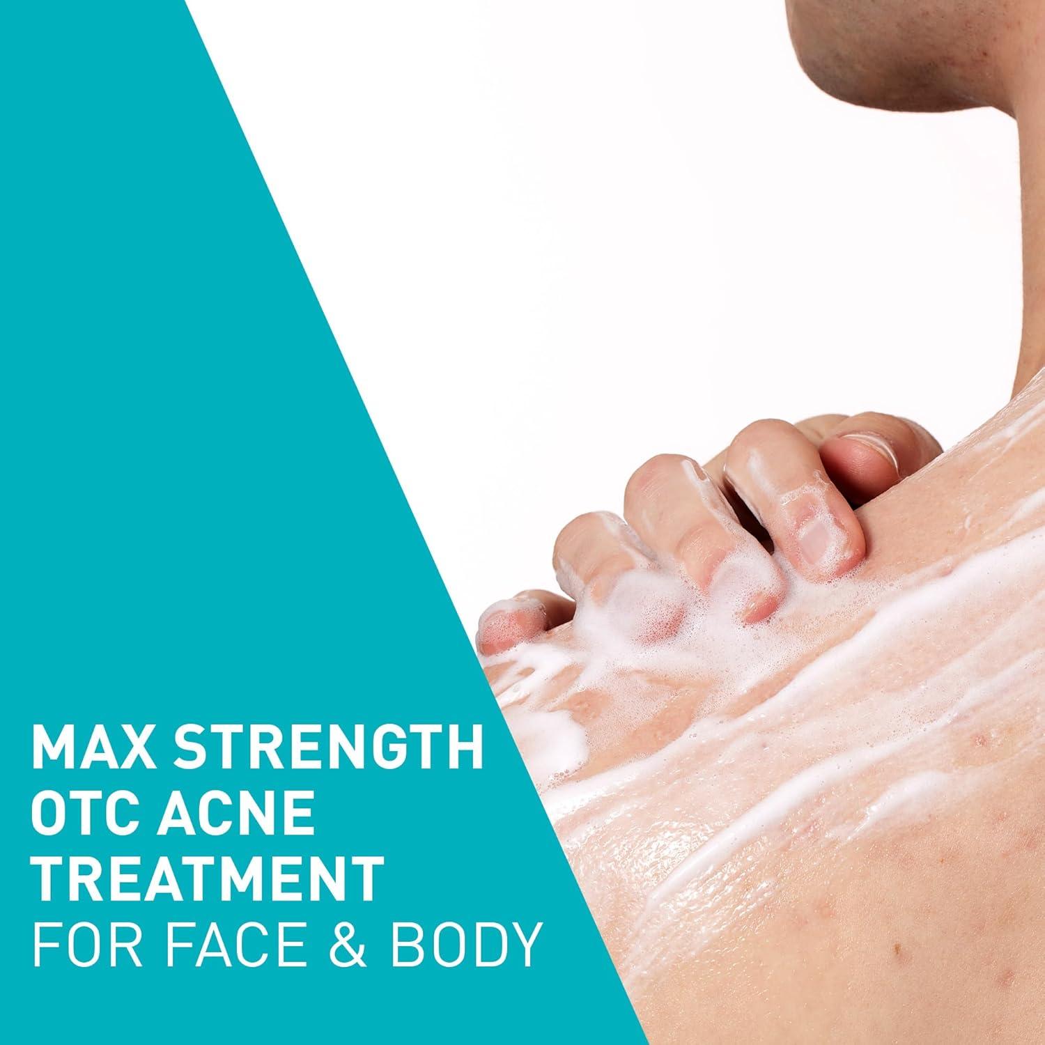 CeraVe Limpiador Espumoso para Acné 10% Peróxido 141g