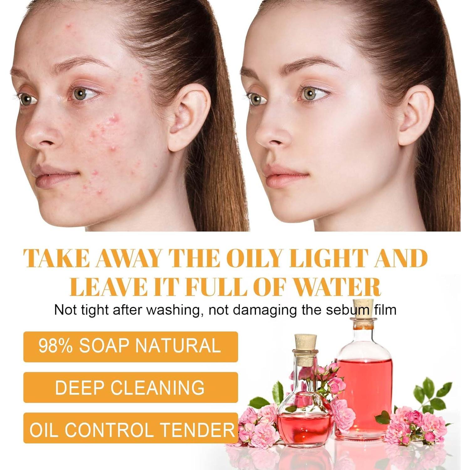 Limpiador Facial Espumoso de Cúrcuma HOYGI 100 ml