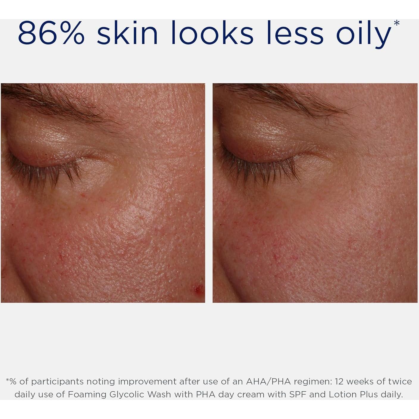 Limpiador Facial Espumoso NEOSTRATA Ácido Glicólico 200ml