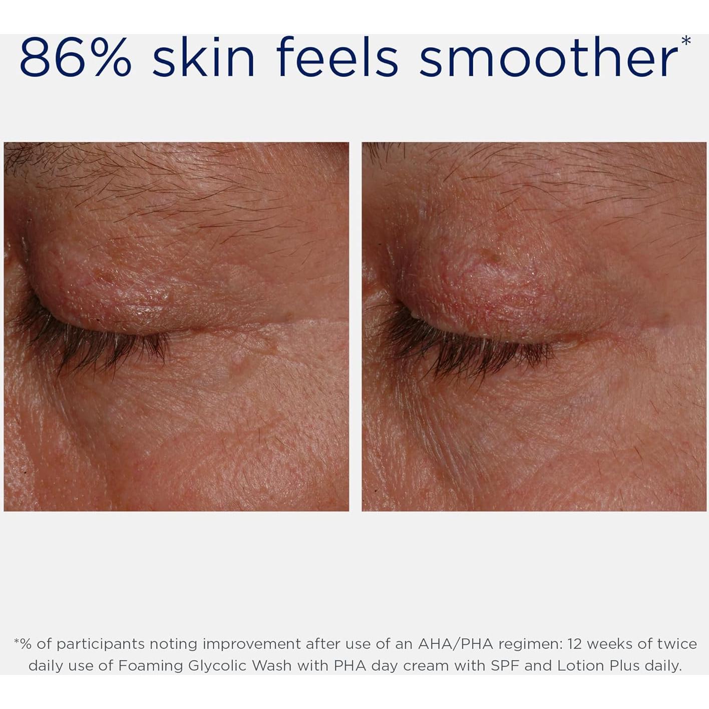 Limpiador Facial Espumoso NEOSTRATA Ácido Glicólico 200ml