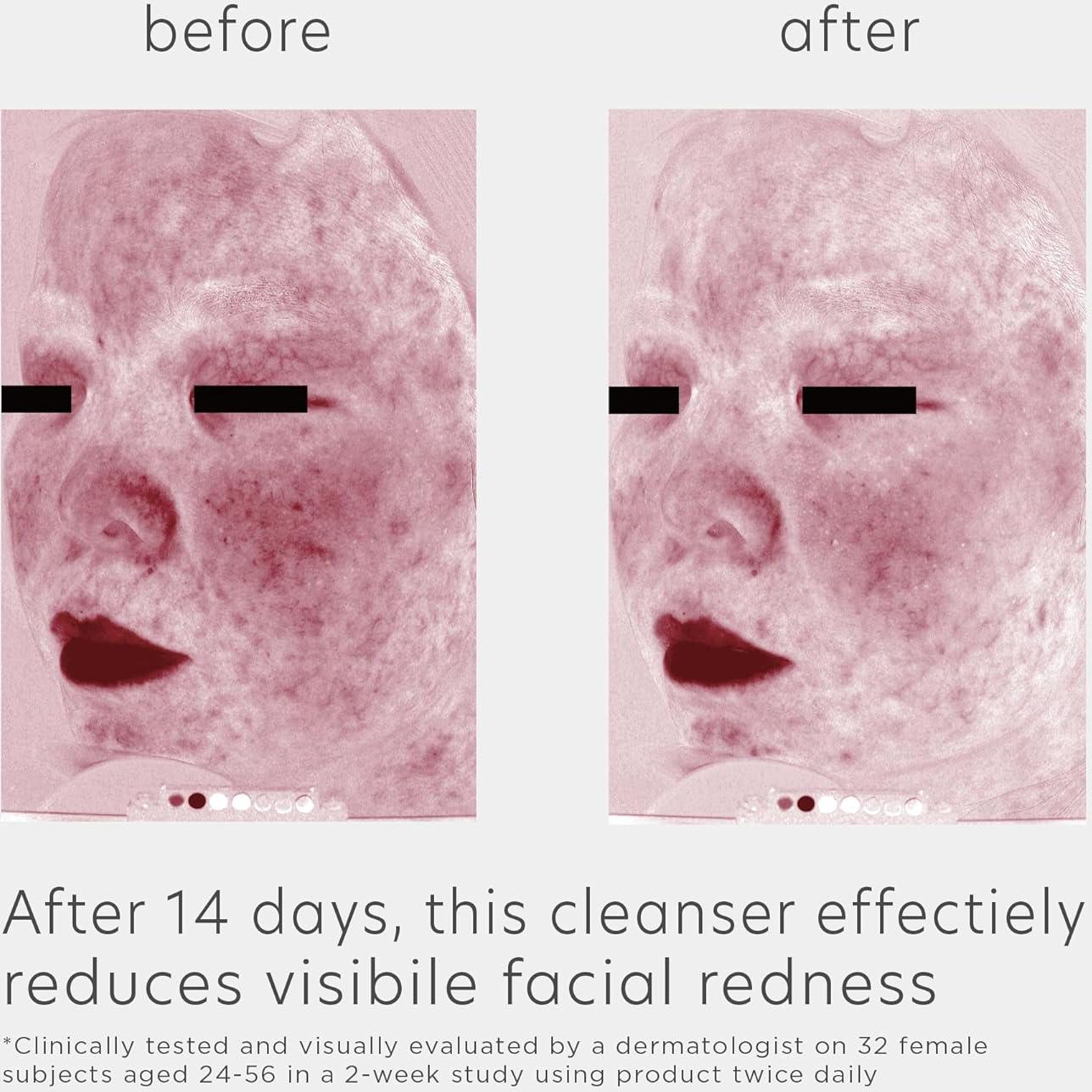 Limpiador Facial Espumoso EltaMD 150ml Piel Sensible