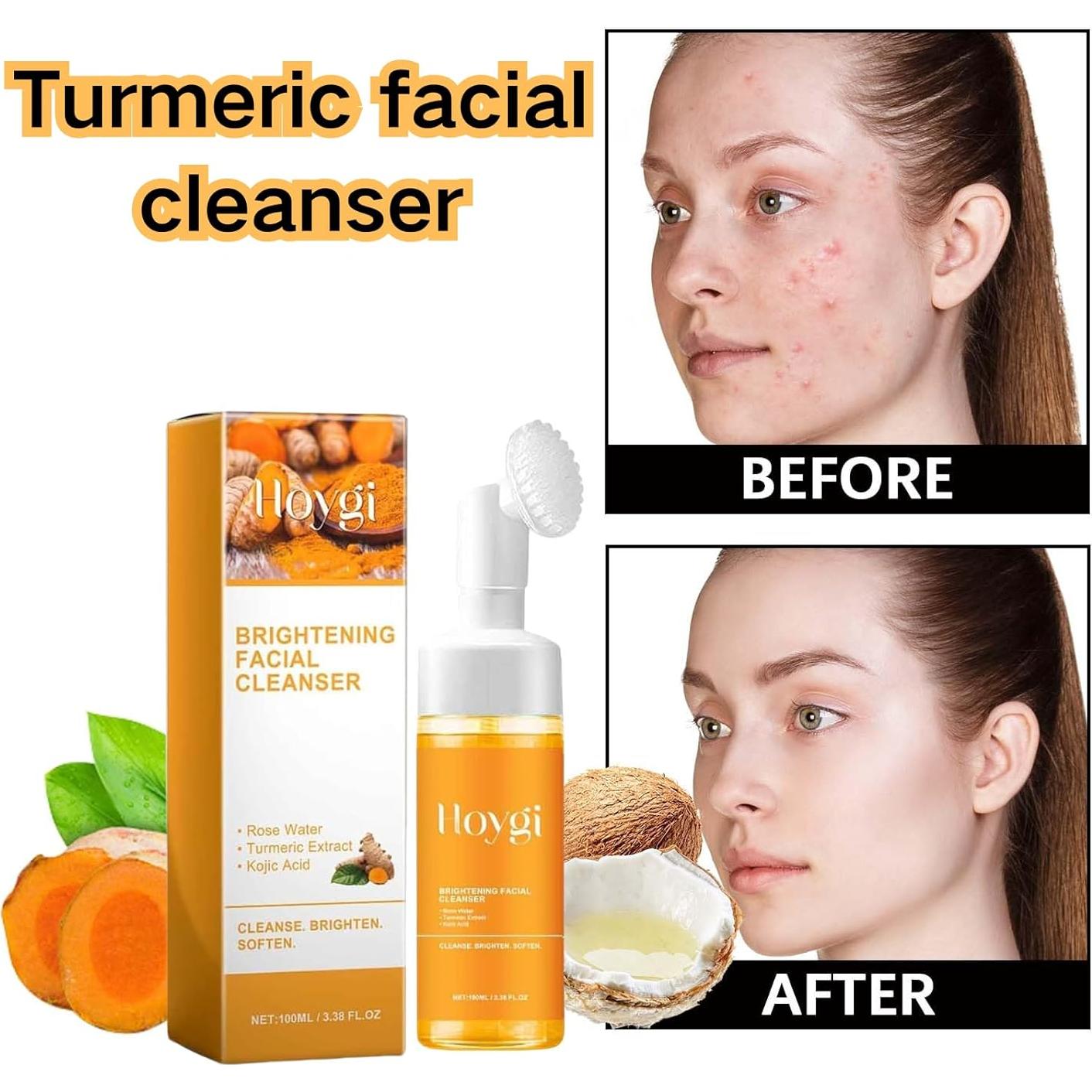 Limpiador Facial de Cúrcuma LANFEIW 2 Piezas 95g