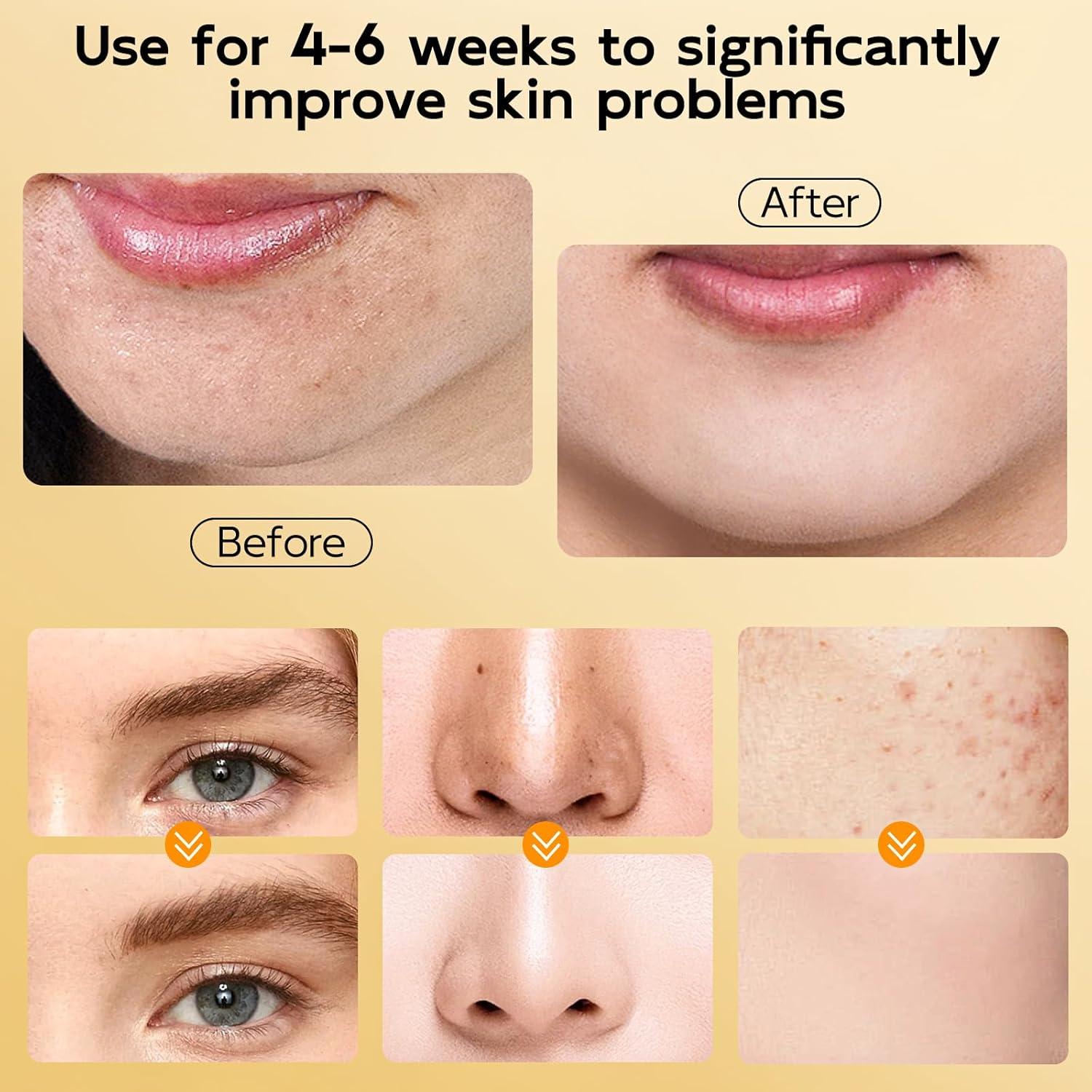 Limpiador Facial Espumoso AOPO 4 en 1 Cúrcuma 95,7 g