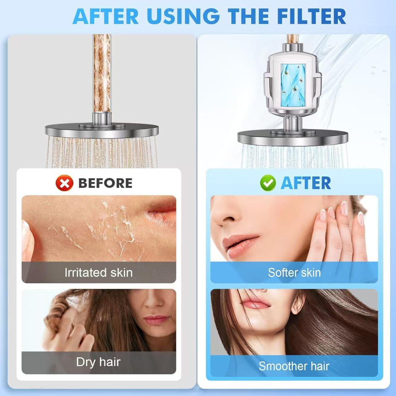 Filtro de Ducha Fphyu 20 Etapas Elimina Cloro y Metales