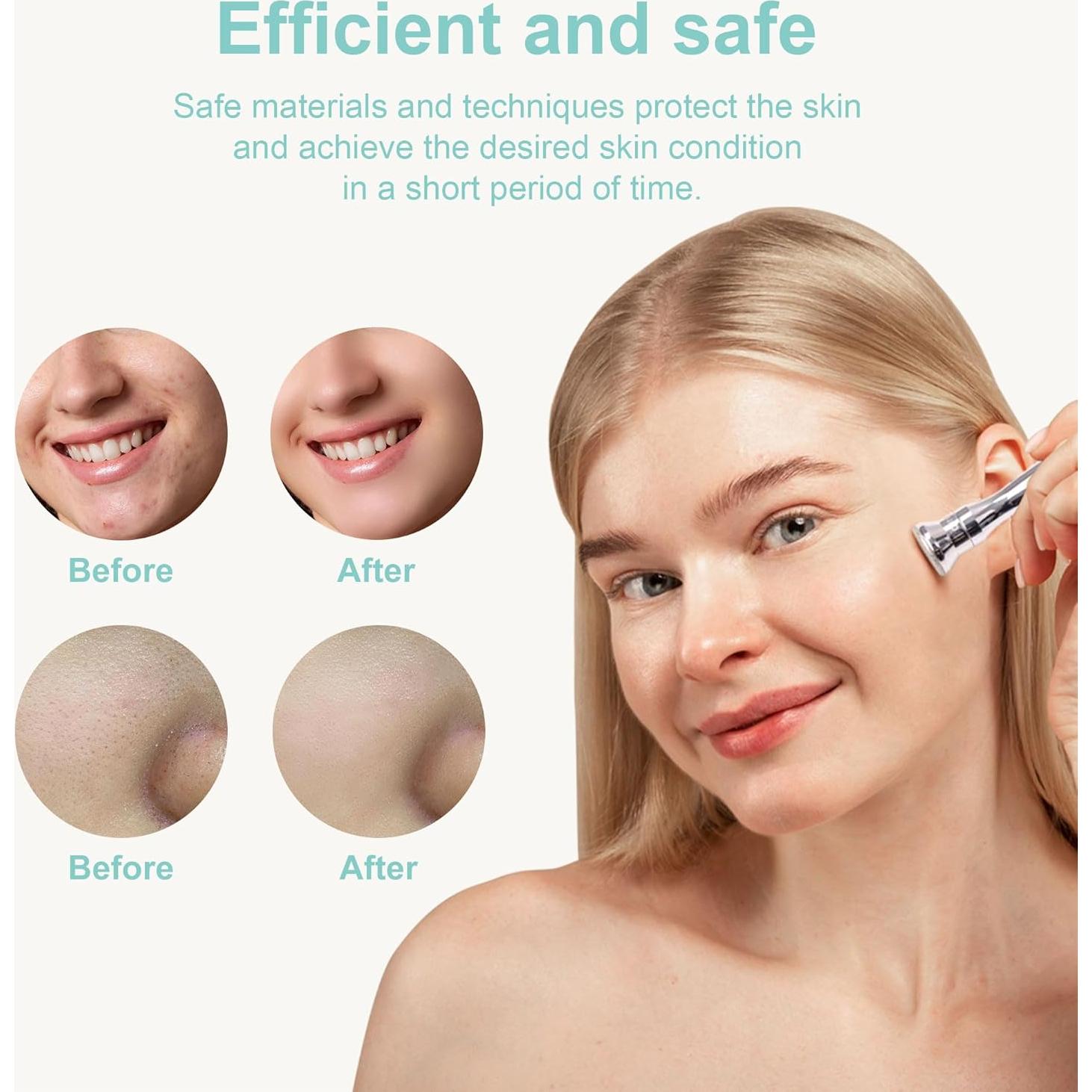 Máquina de Microdermoabrasión Kendal Diamond 4.69kg