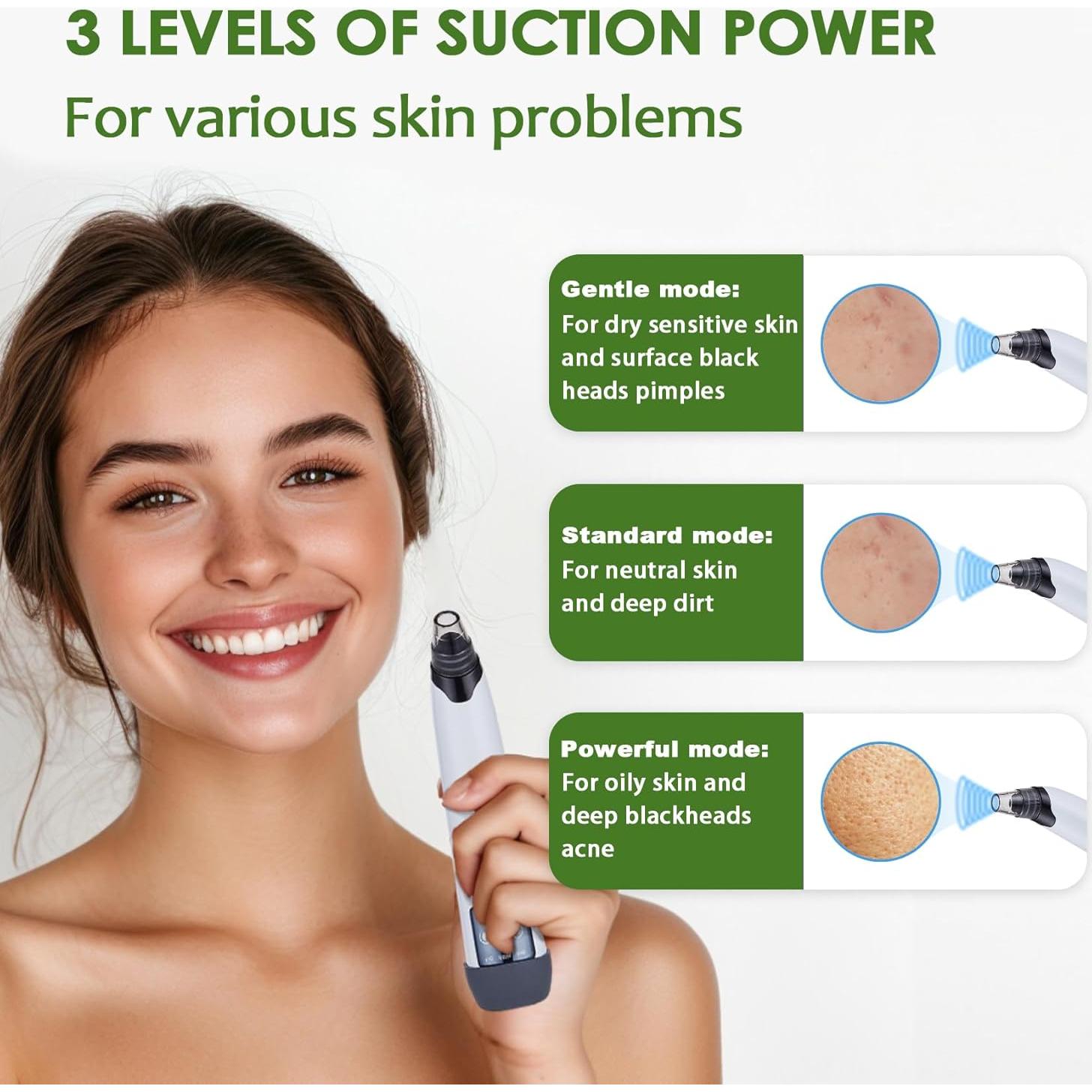 Aspiradora de Puntos Negros Xamoca USB 3 Niveles 4 Probes