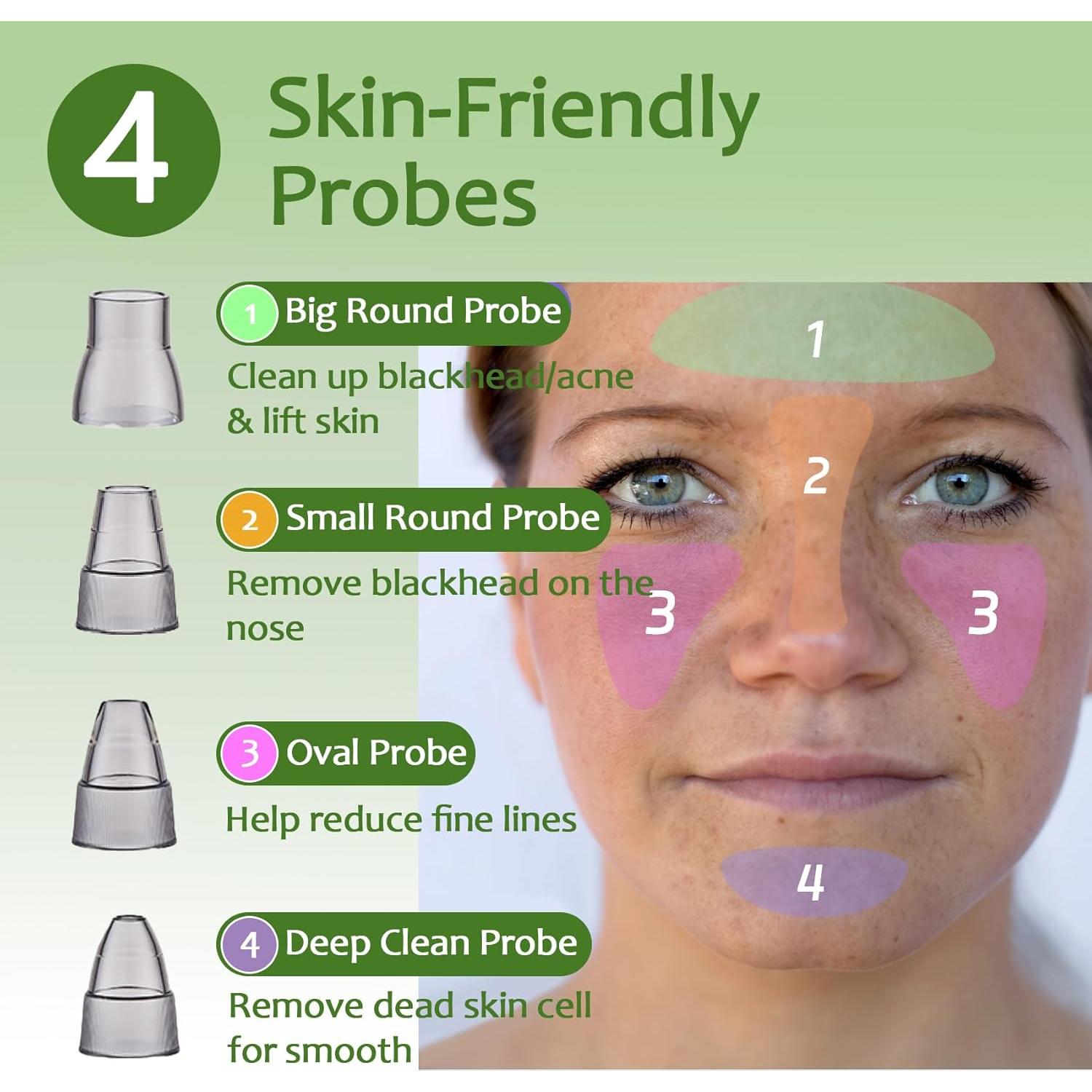 Aspiradora de Puntos Negros Xamoca USB 3 Niveles 4 Probes