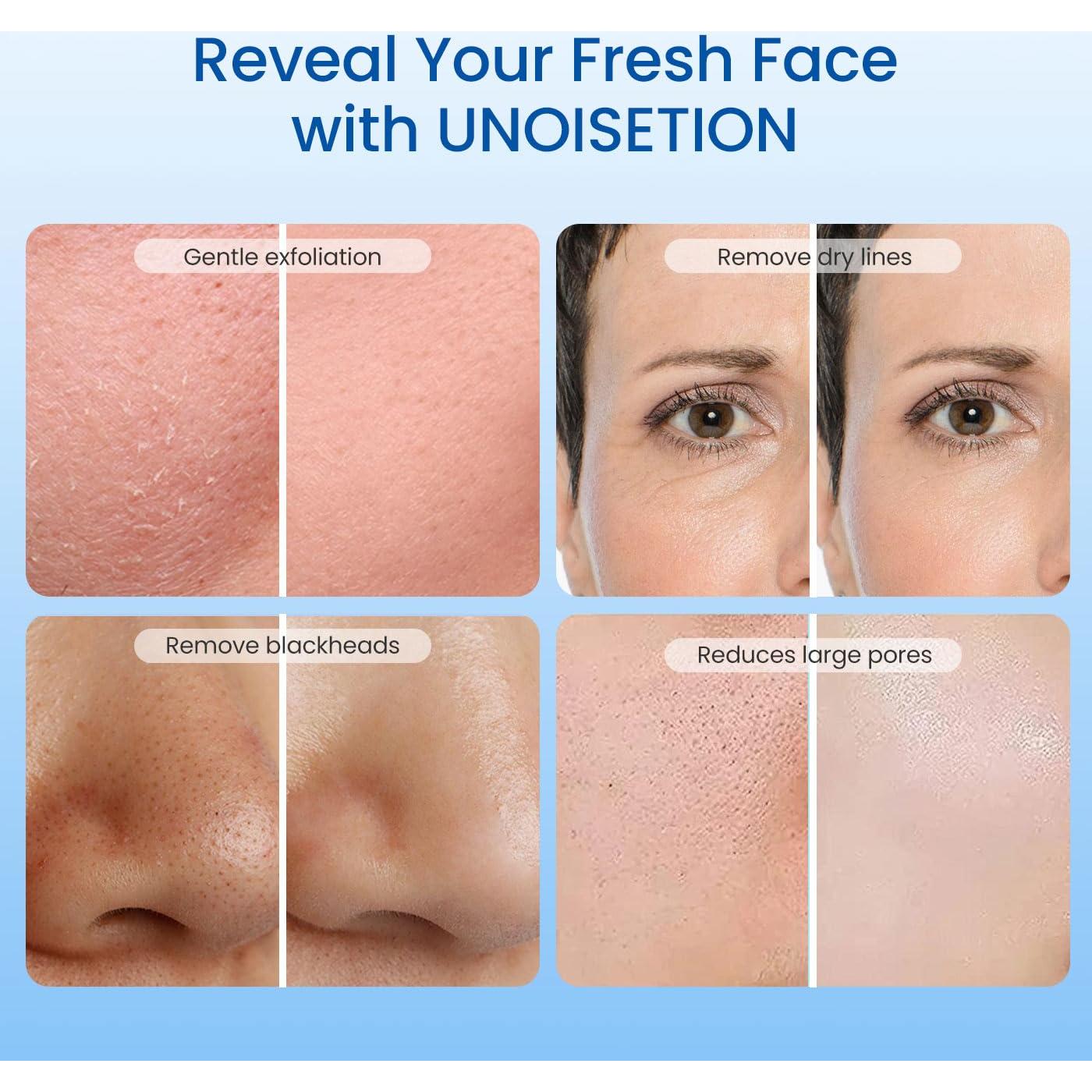 Máquina de Microdermoabrasión UNOISETION 3 en 1 para Piel Suave