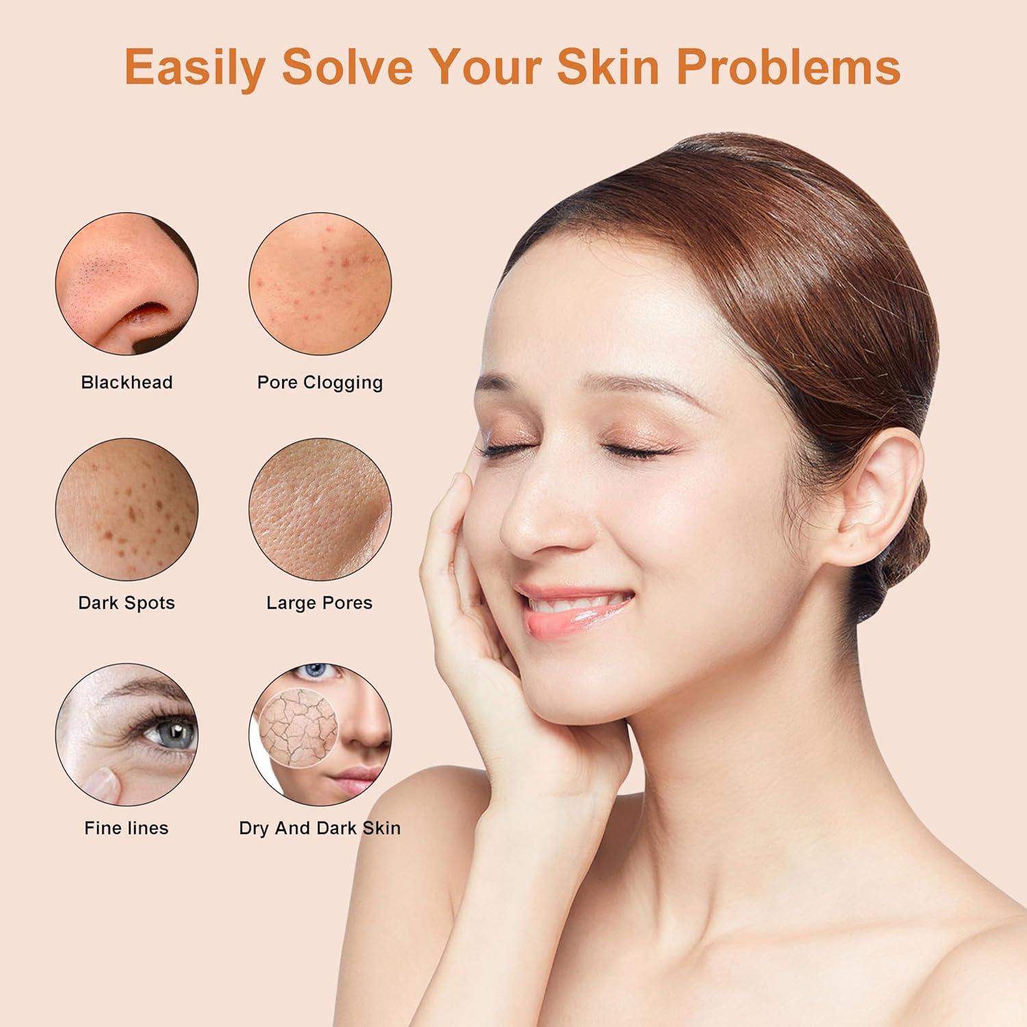 Exfoliador Facial 4 en 1 Elitzia ET33P4 Microdermoabrasión