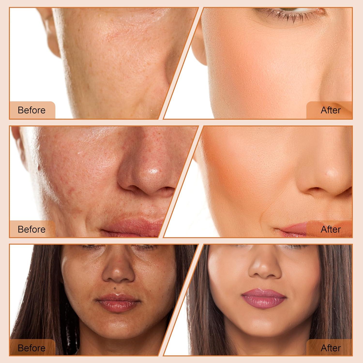 Exfoliador Facial 4 en 1 Elitzia ET33P4 Microdermoabrasión