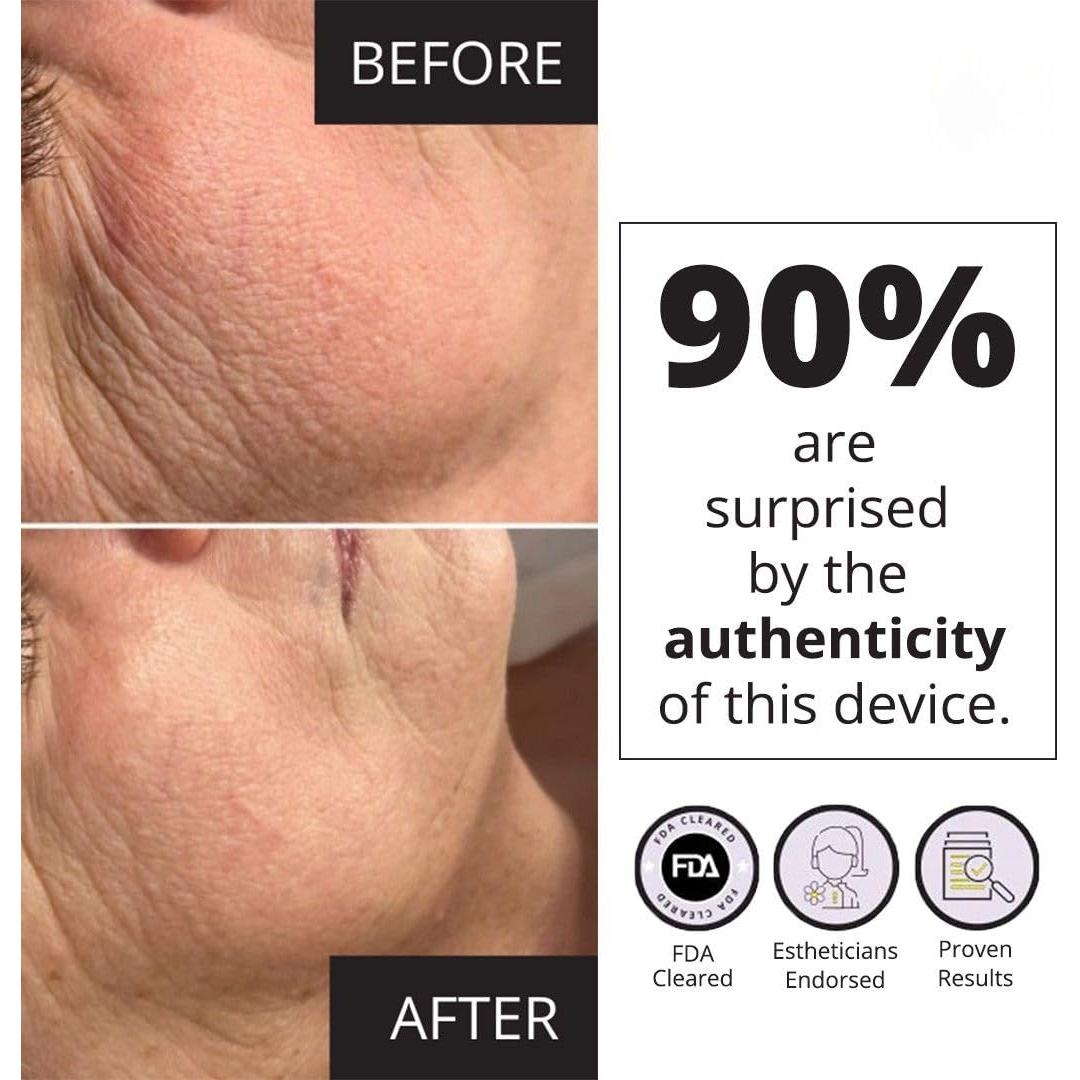 Dispositivo Facial MyoLift Mini 7E Wellness - Microcorriente 400mA