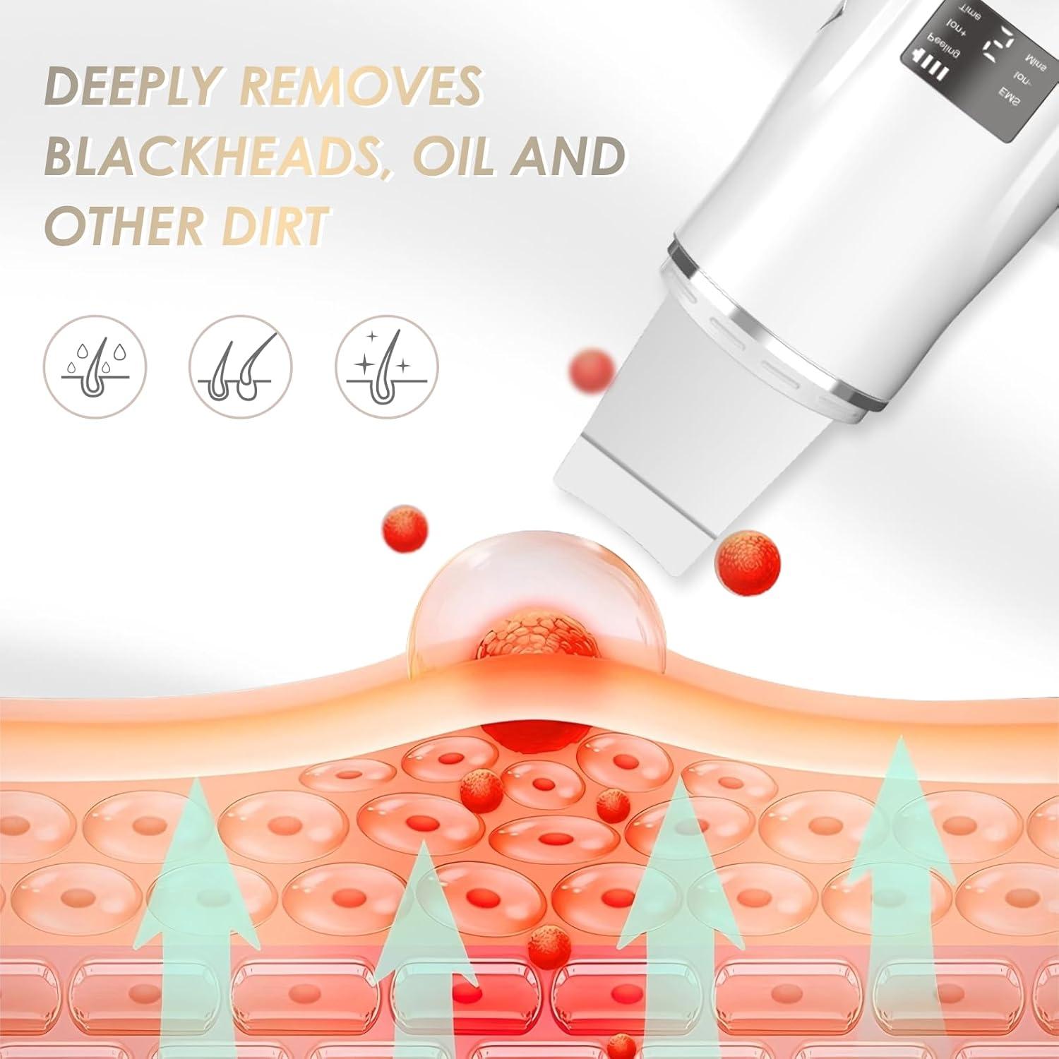 Espátula Facial Liedrg VP3 4 en 1 con Cargador USB