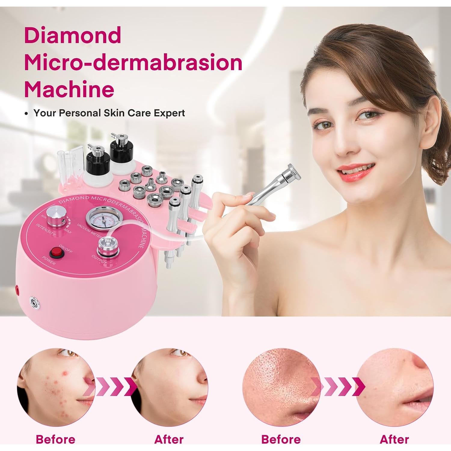 Máquina de Microdermoabrasión Yofuly 3 en 1 Rosa - Cuidado Facial