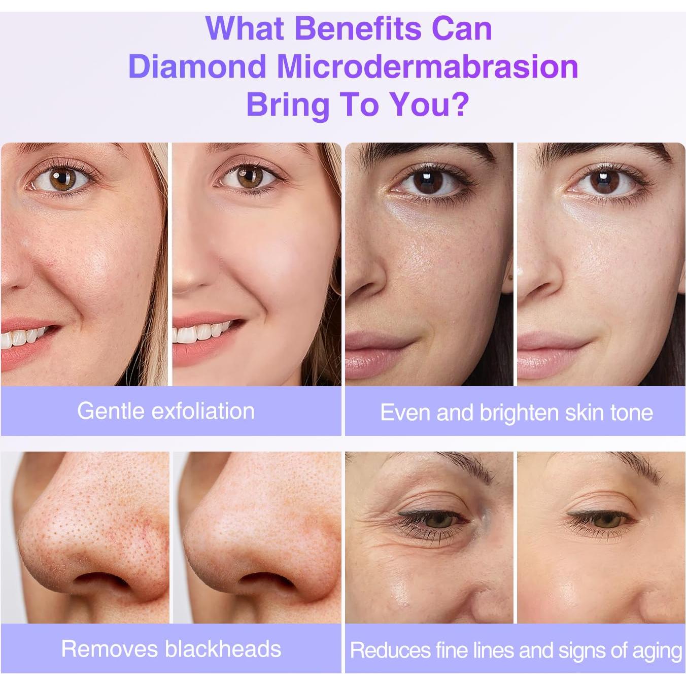 Consejos de Microdermoabrasión de Diamante UNOISETION 9 Piezas