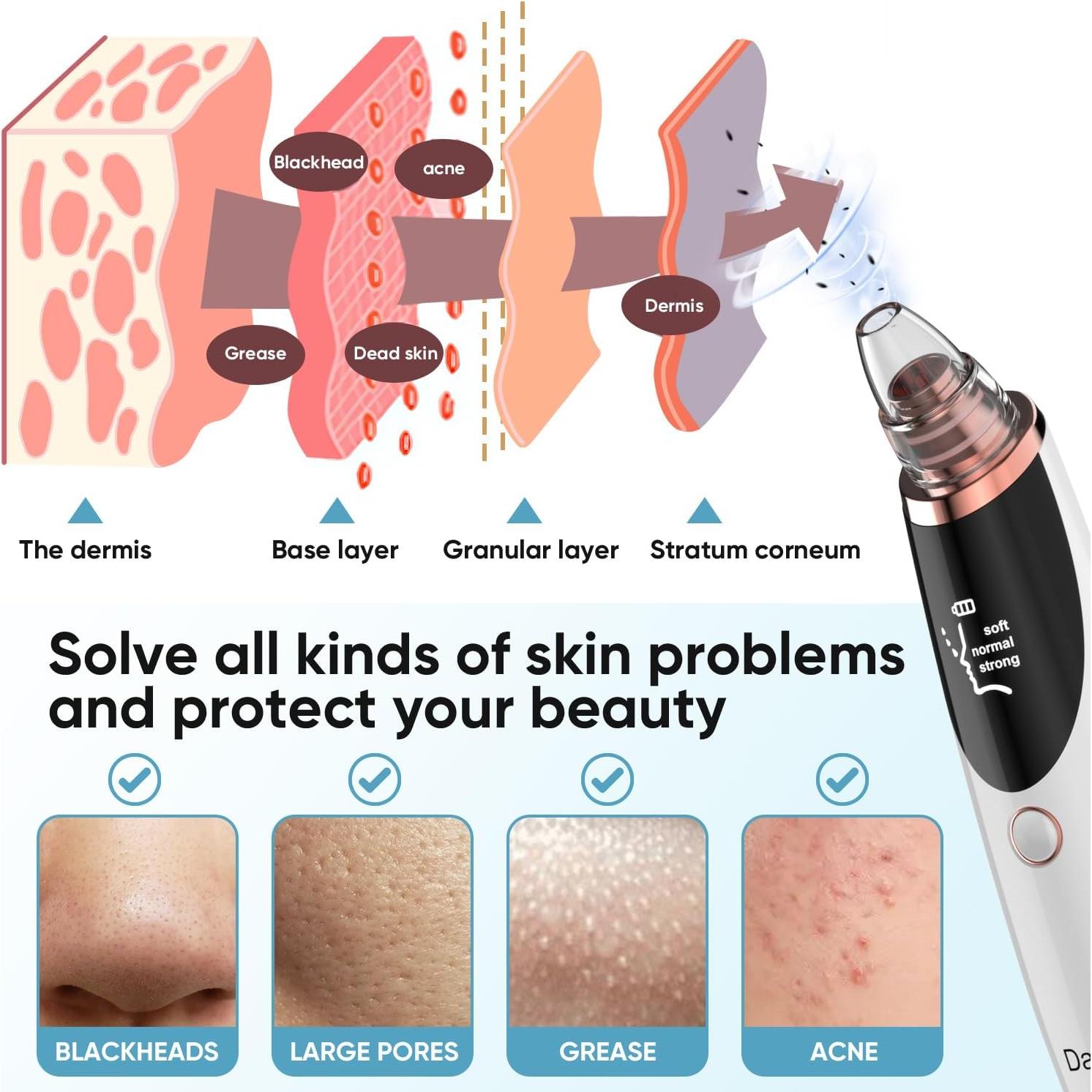 Extractor de Puntos Negros Daweir H001 - Aspirador Facial