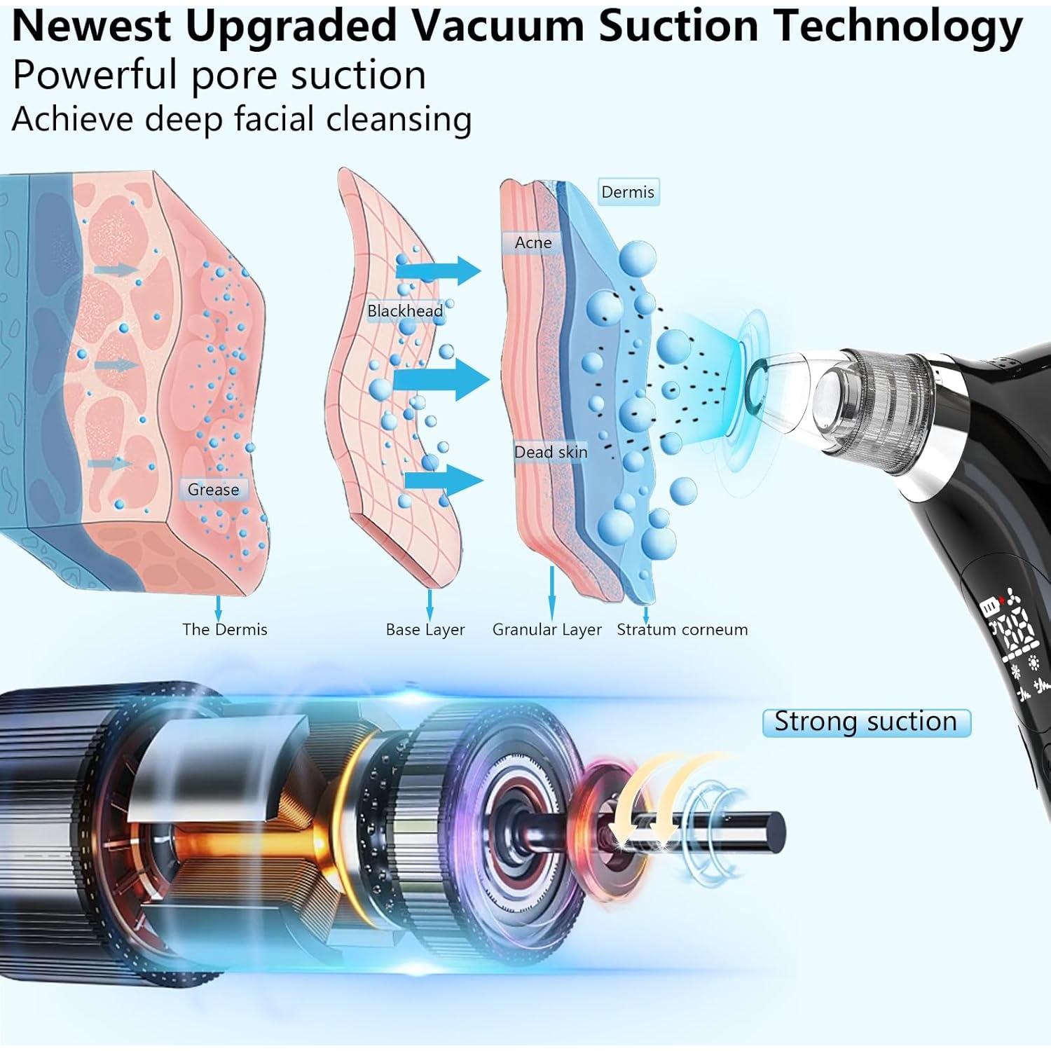 Limpiador de Poros SJIE QC208 con Masaje y Calor - Negro