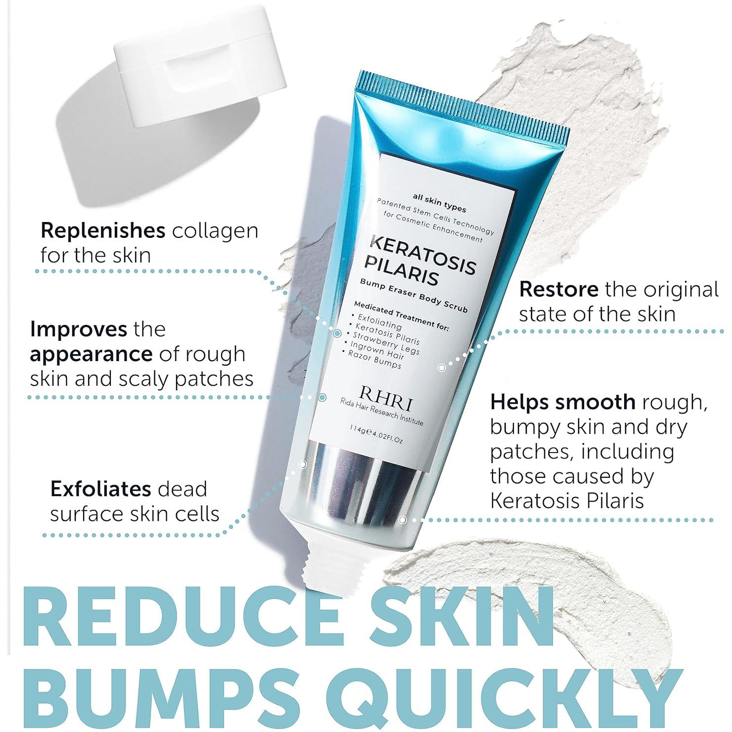 Exfoliante Corporal KP Bump Eraser 15,6x6,3 cm - Hidratante