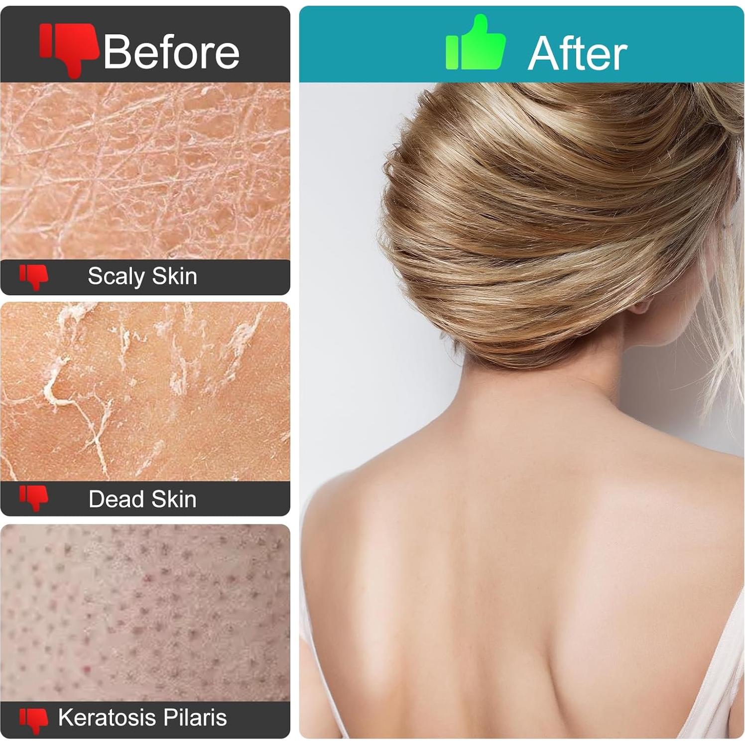 Guantes Exfoliantes LCOCWMY 4 Piezas Exfoliación Corporal