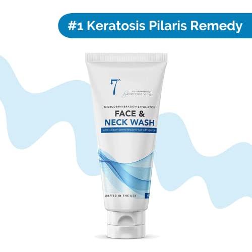 Exfoliante Microdermoabrasión EverclearNow 113g Piel Suave