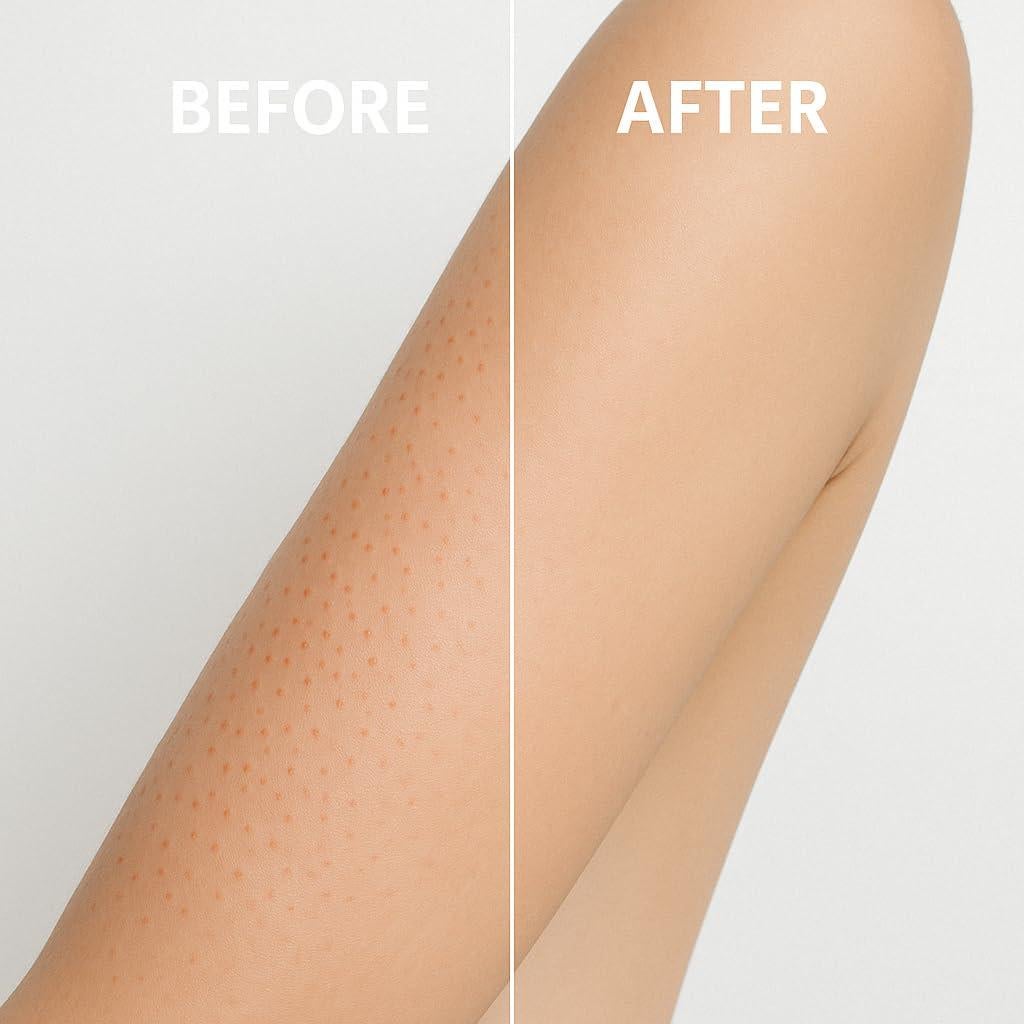 Exfoliante Microdermoabrasión EverclearNow 113g Piel Suave