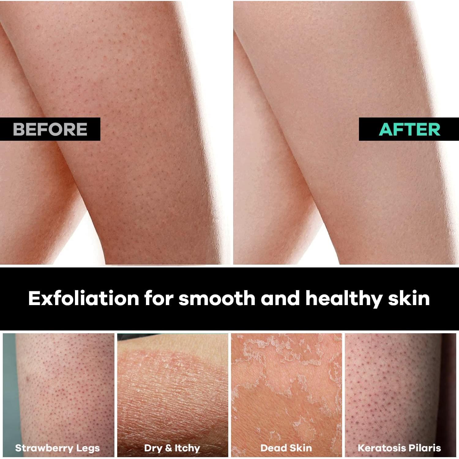 Conjunto Exfoliante Corporal Dermasuri - Mitón y Cepillo