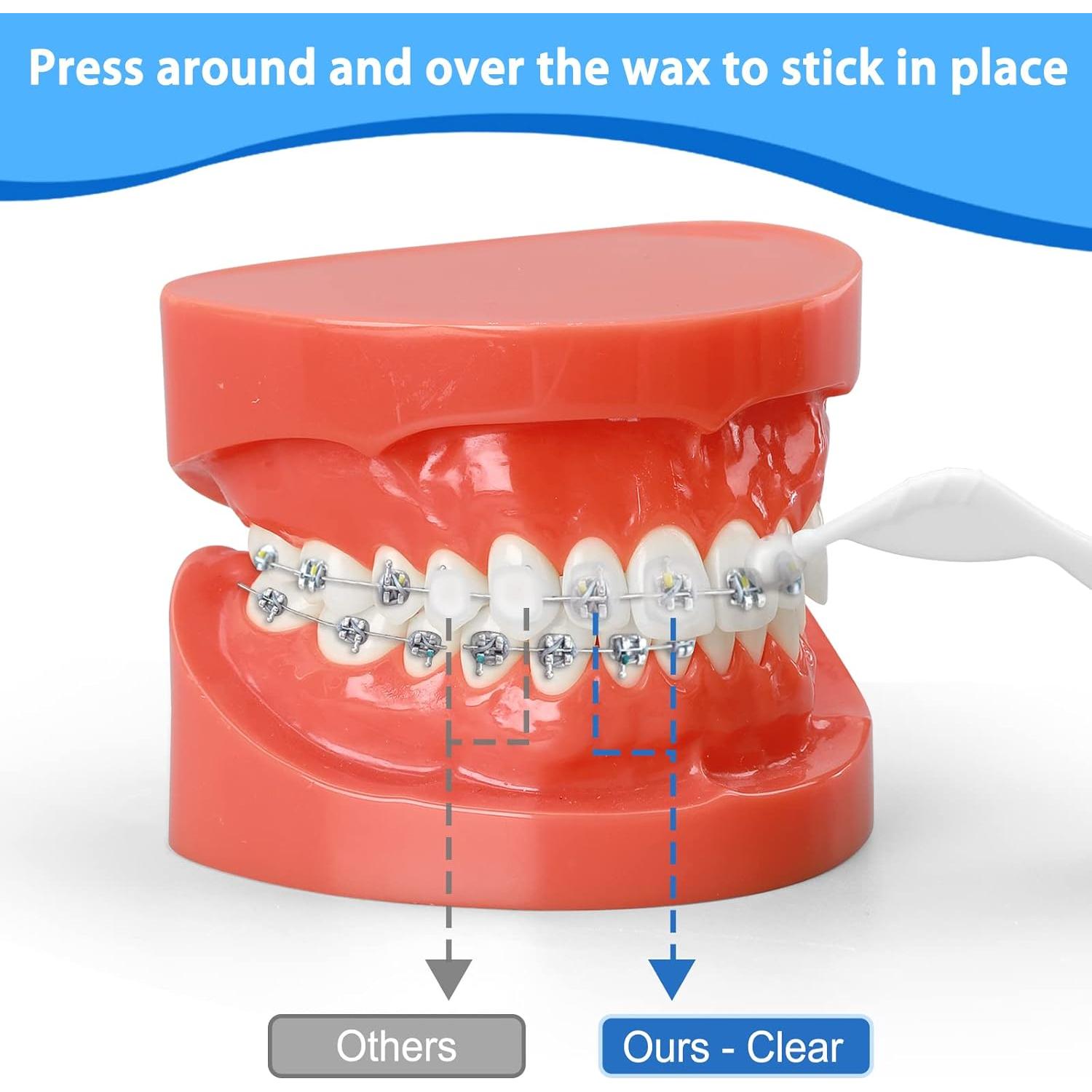 Cera para Brackets Wellcale 10 Paquetes Menta Aloe Vera