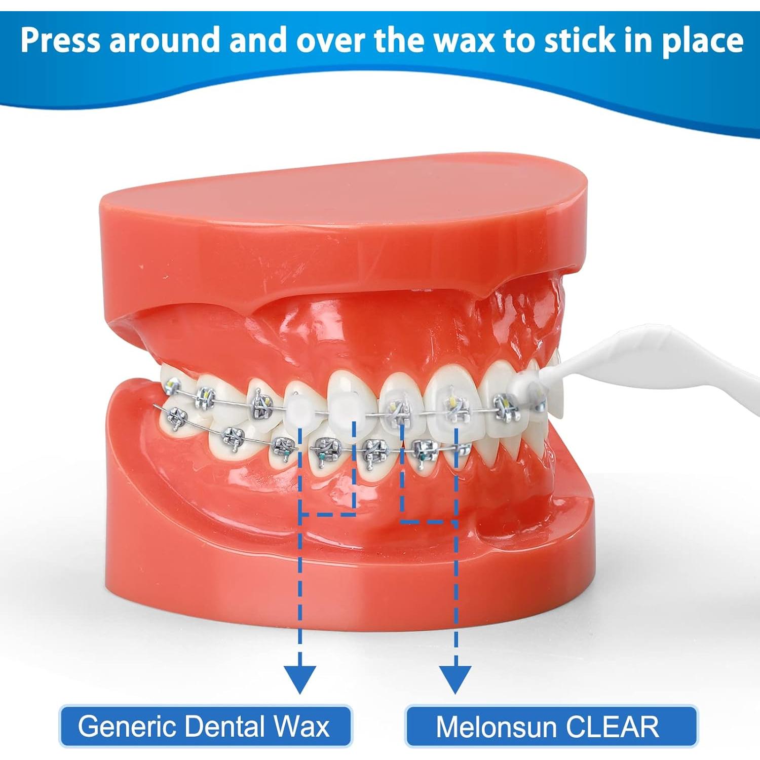 Cera para Brackets Melonsun - 10 Paquetes Pre-cortados