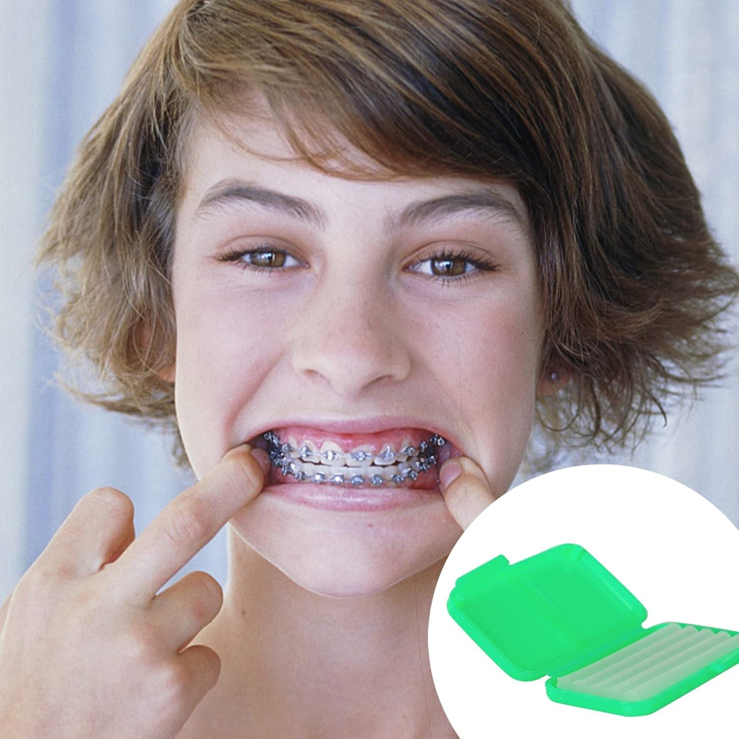 Cera Dental MorTime 12 Pack para Brackets y Alineadores