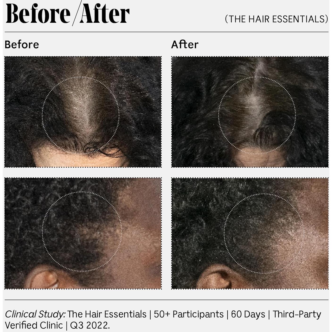 Acondicionador Hipoalergénico Necessaire 340g Ácido Hialurónico