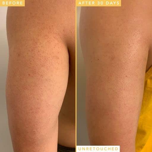 Suero Corporal AHA BHA Farmacia Luna de Miel 149.7g