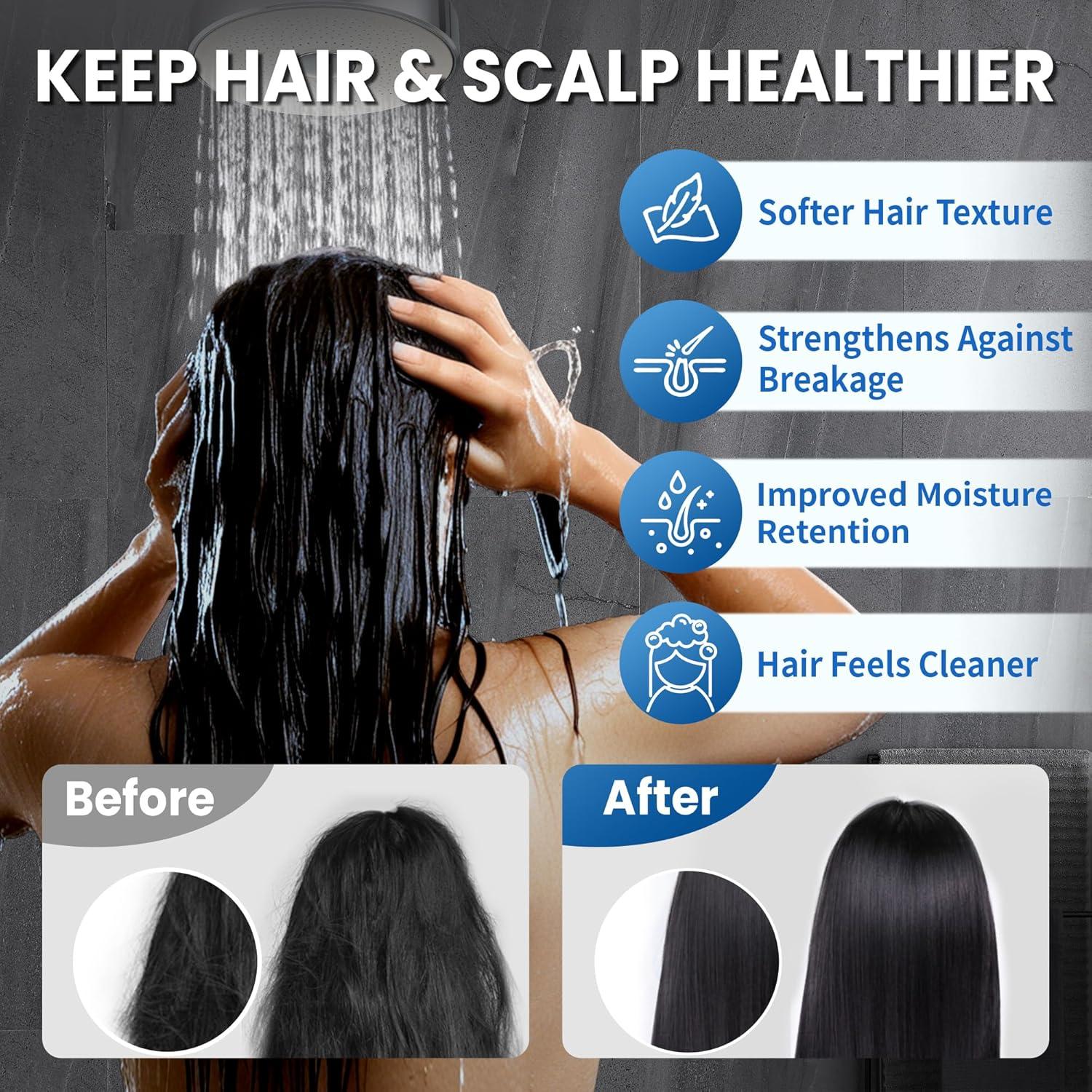 Cabezal de Ducha Filtrado IceJoy - Alta Eficiencia Negro Mate