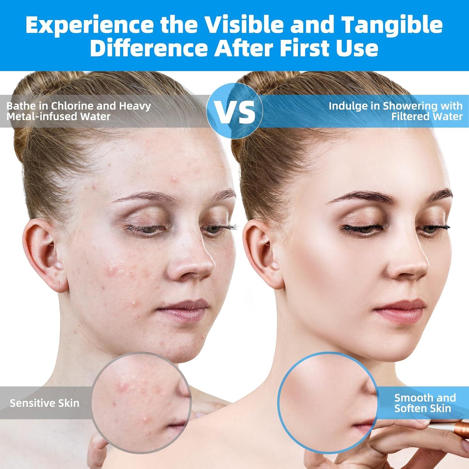 Cartuchos de Reemplazo Filtro de Ducha Hibbent 2 Pack