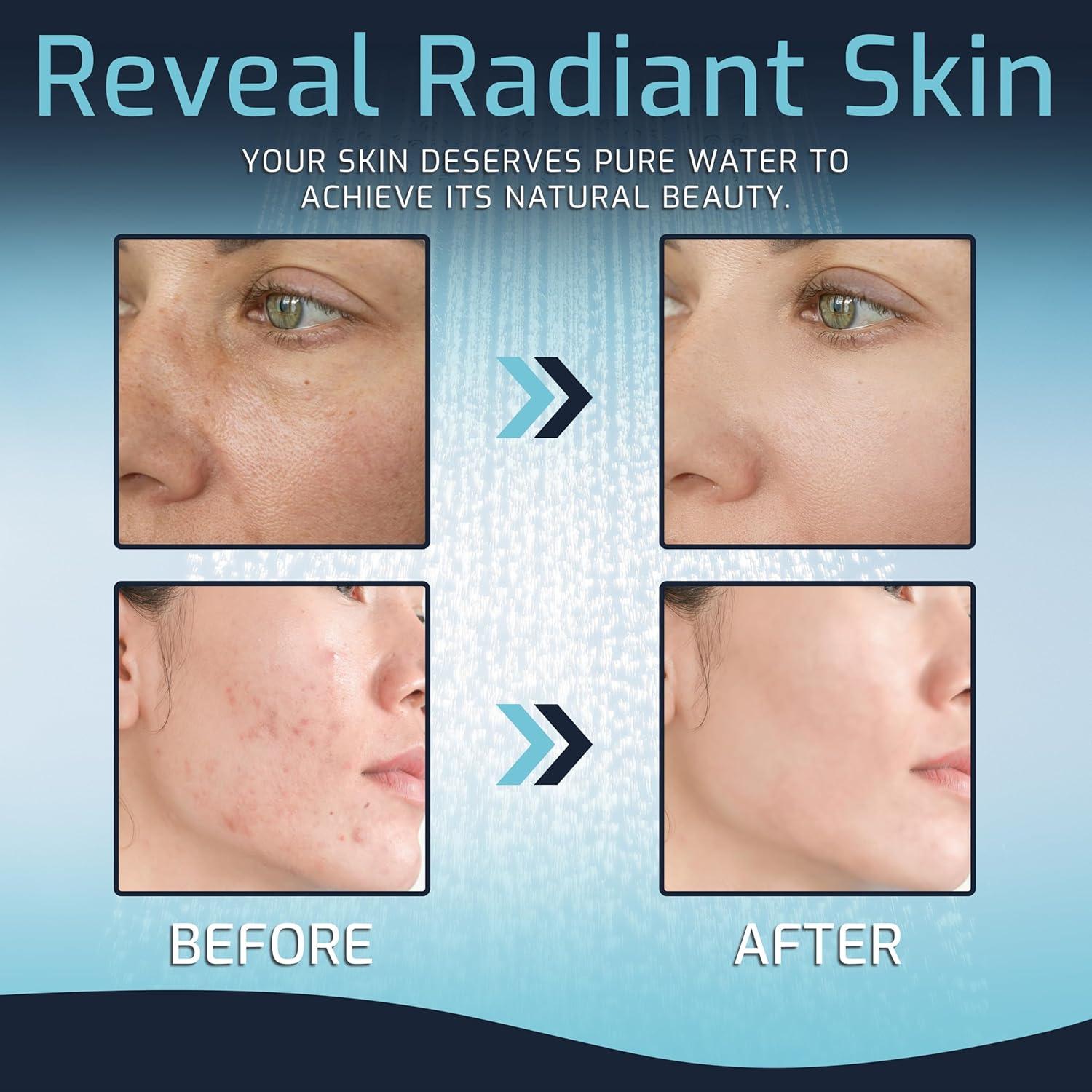 Filtro de Ducha Mist 5 Modos Cromo 9.46 L/min 15 Etapas