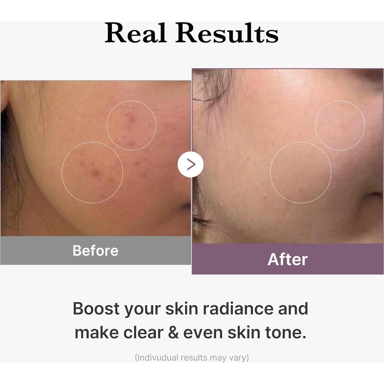 Tónico Milky Medicube Age-R Glutathione 200ml Piel Radiante