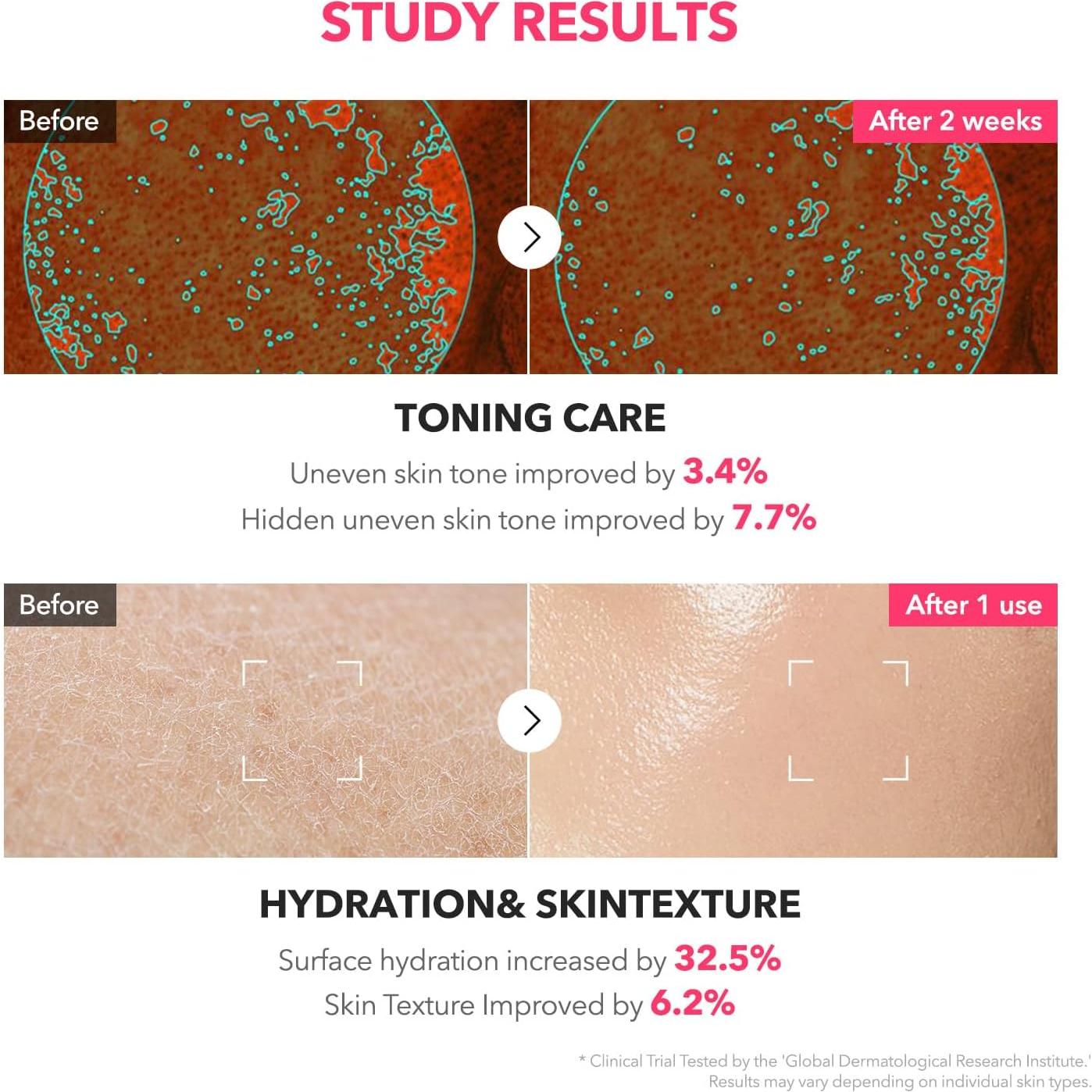 Tónico Lechoso Rosa APRILSKIN 150ml TXA 3% Niacinamida 5%