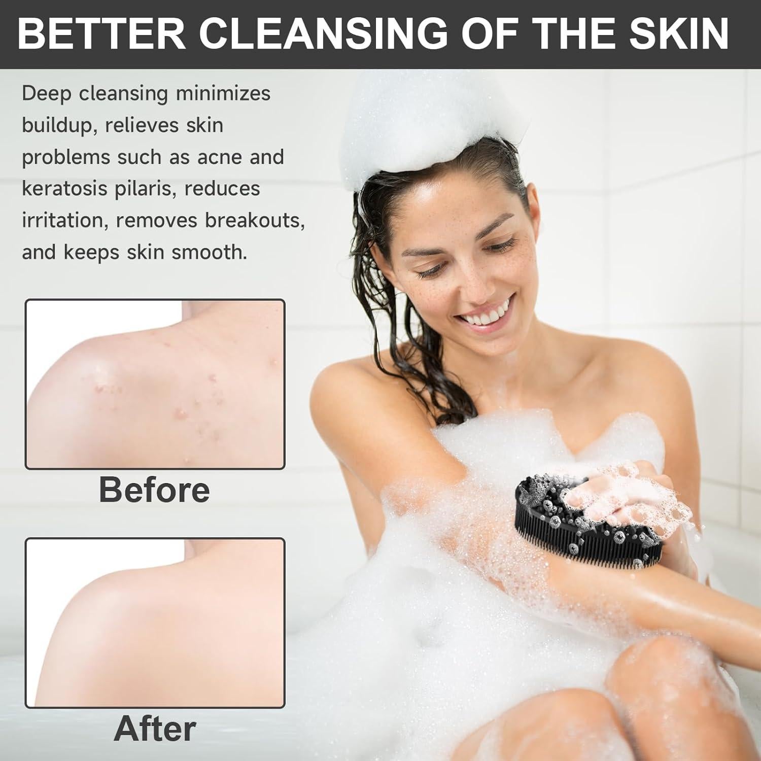 Exfoliante de Silicona Metene para Cuerpo - Negro 11.94 cm