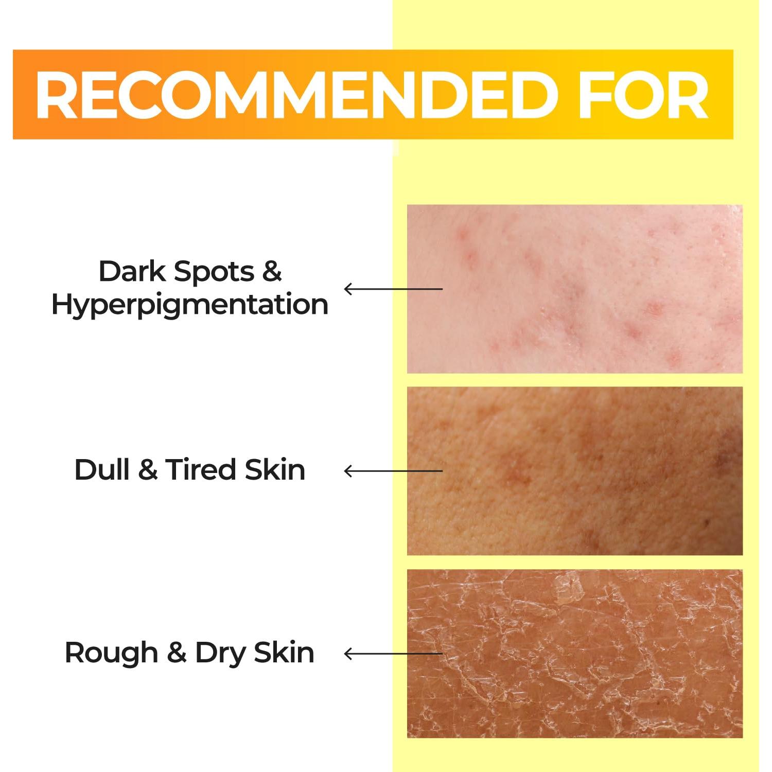 Tónico Esencial Numbuzin No.5 200ml - Mejora Tono Piel