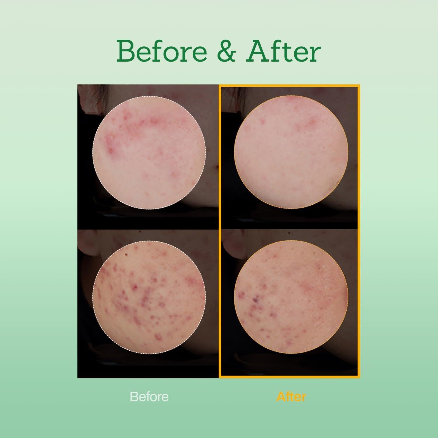 Tónico Hidratante Coreano COSMECCA 250ml Piel Sensible