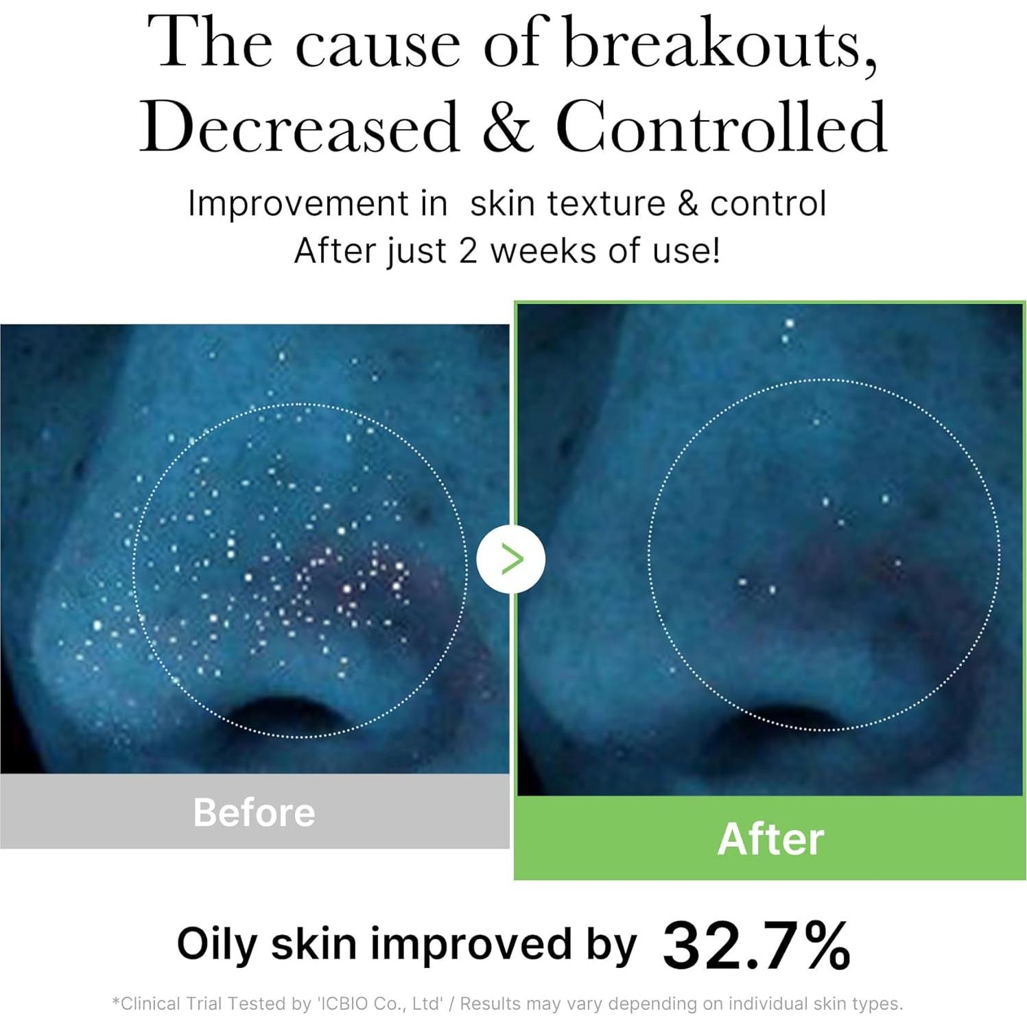 Tónico Calmante Diario Medicube Exosome CICA 210ml